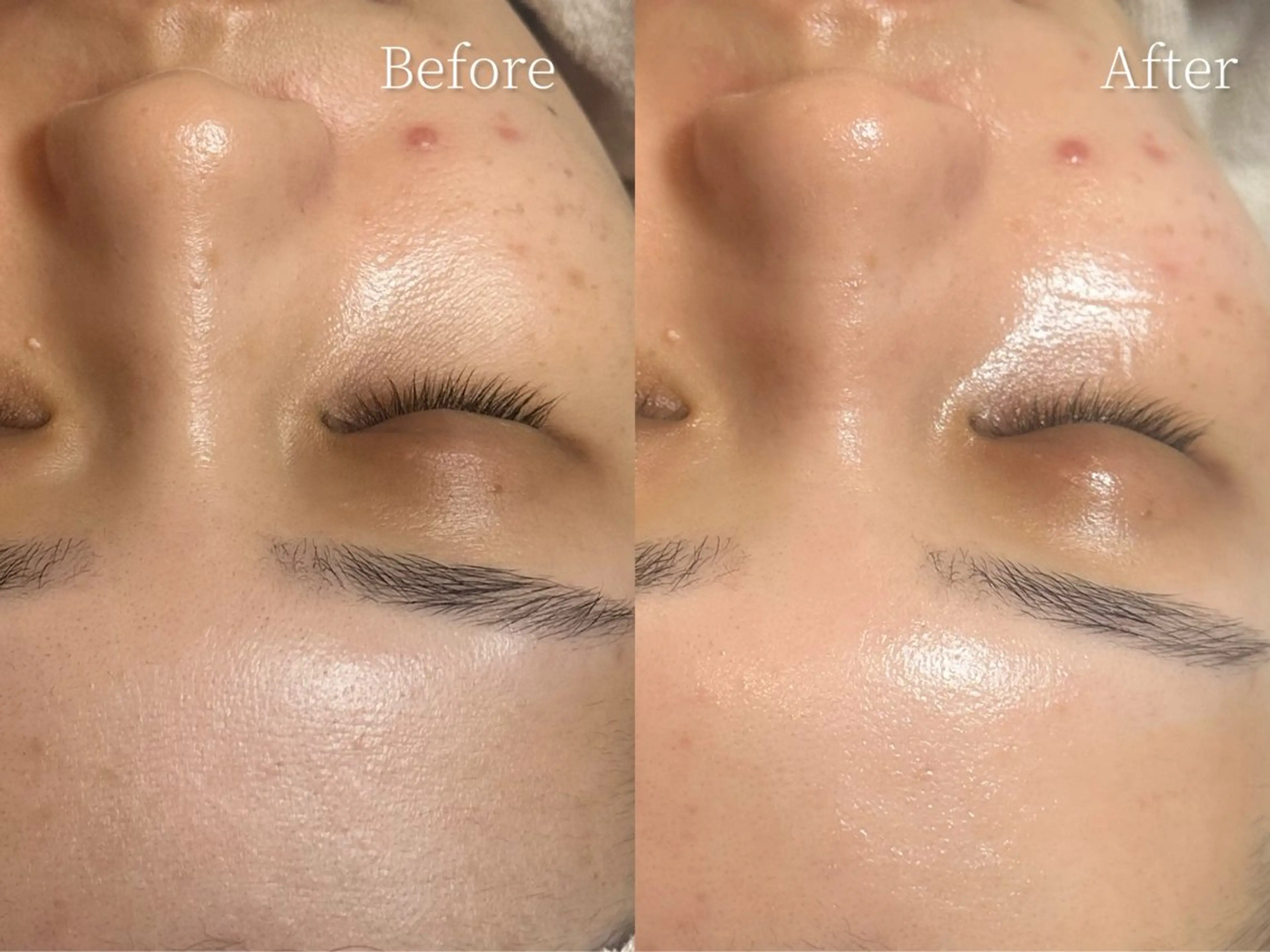 エステ MilleTendresses所属・本町オールハンド リラク/女性専用💐のエステ・リラクイメージ