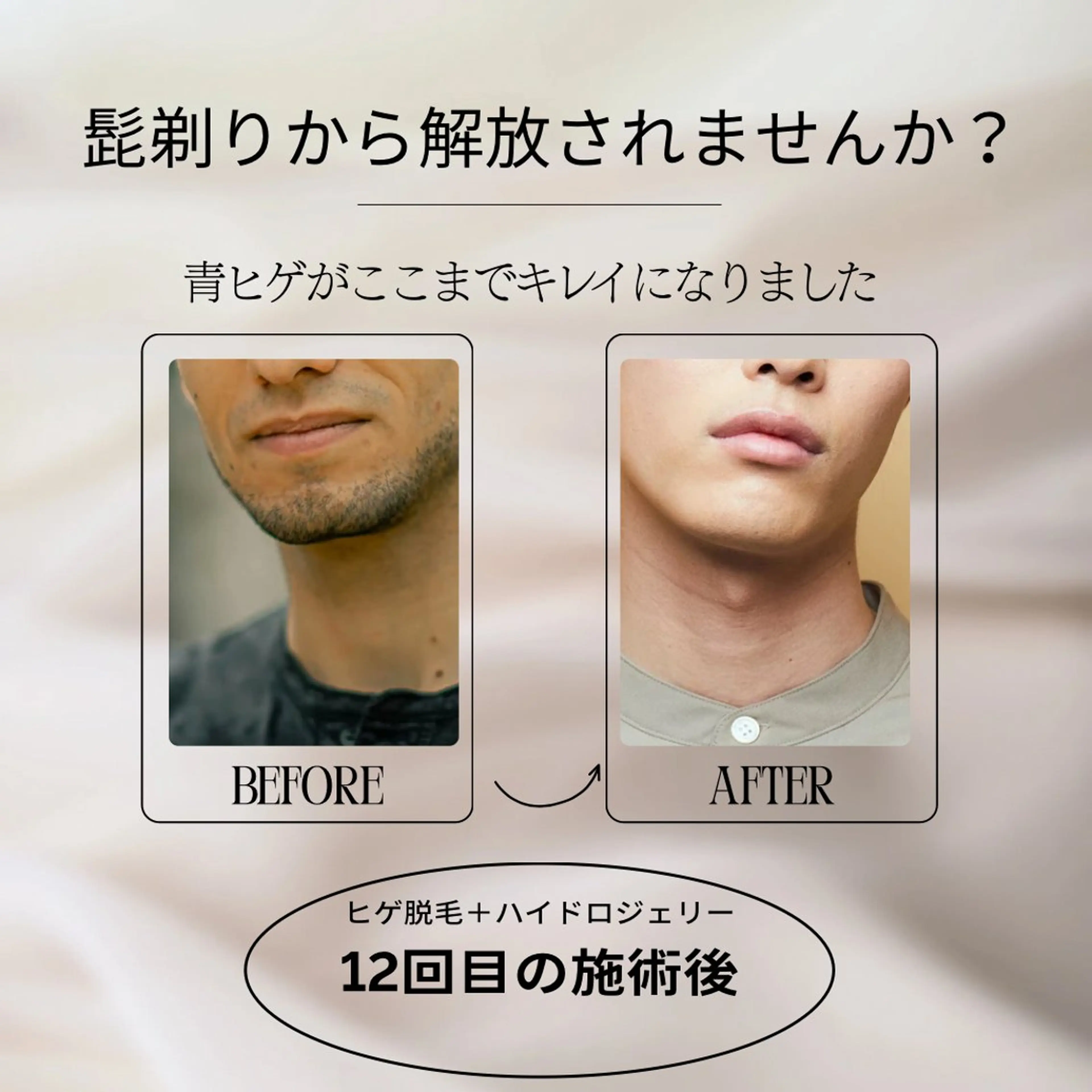 メンズ 脱毛 レティティア【Laetitia】所属・レティティア秋葉原店 Yoshizawaのエステ・リラクイメージ