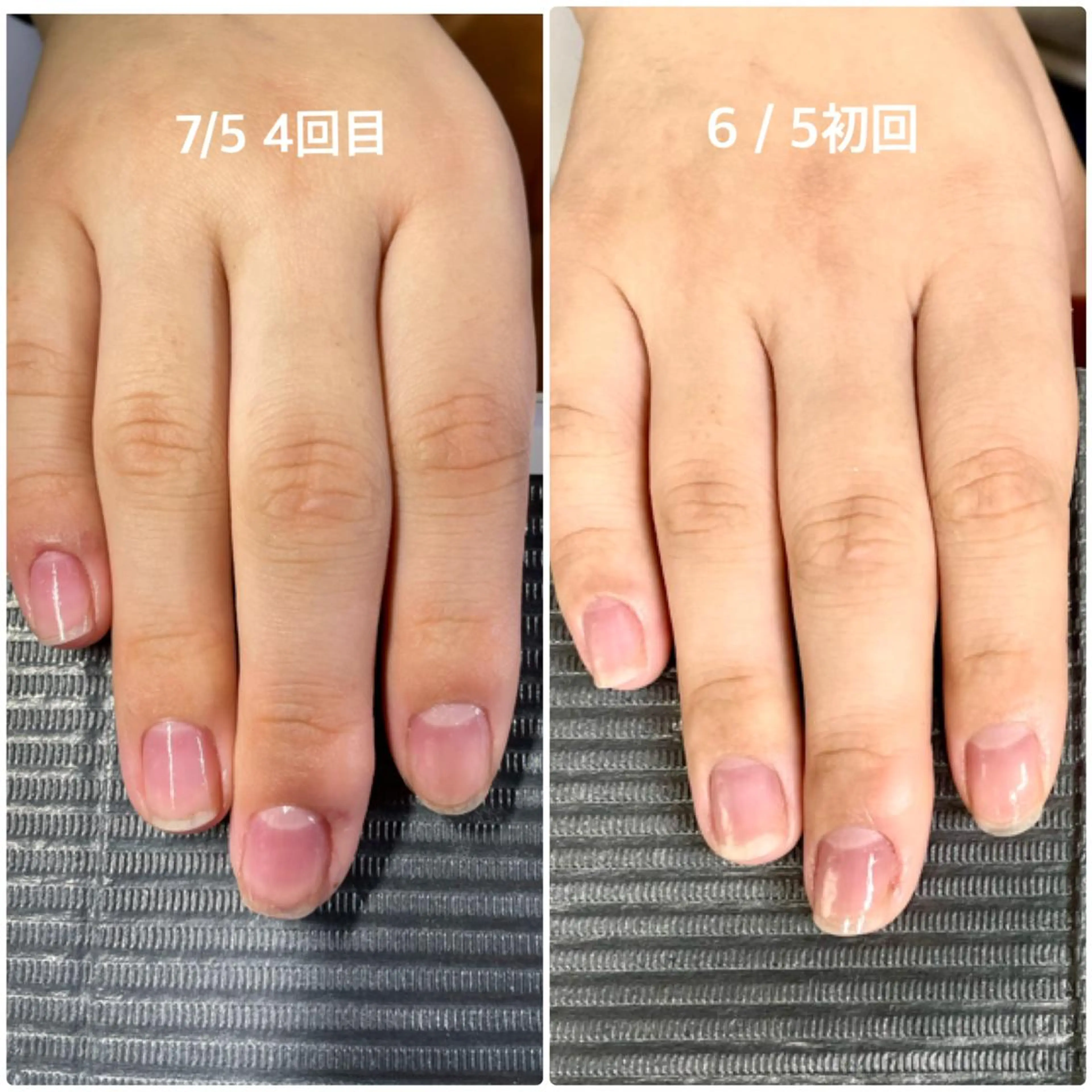 ネイル 奥園 良恵のネイルデザイン