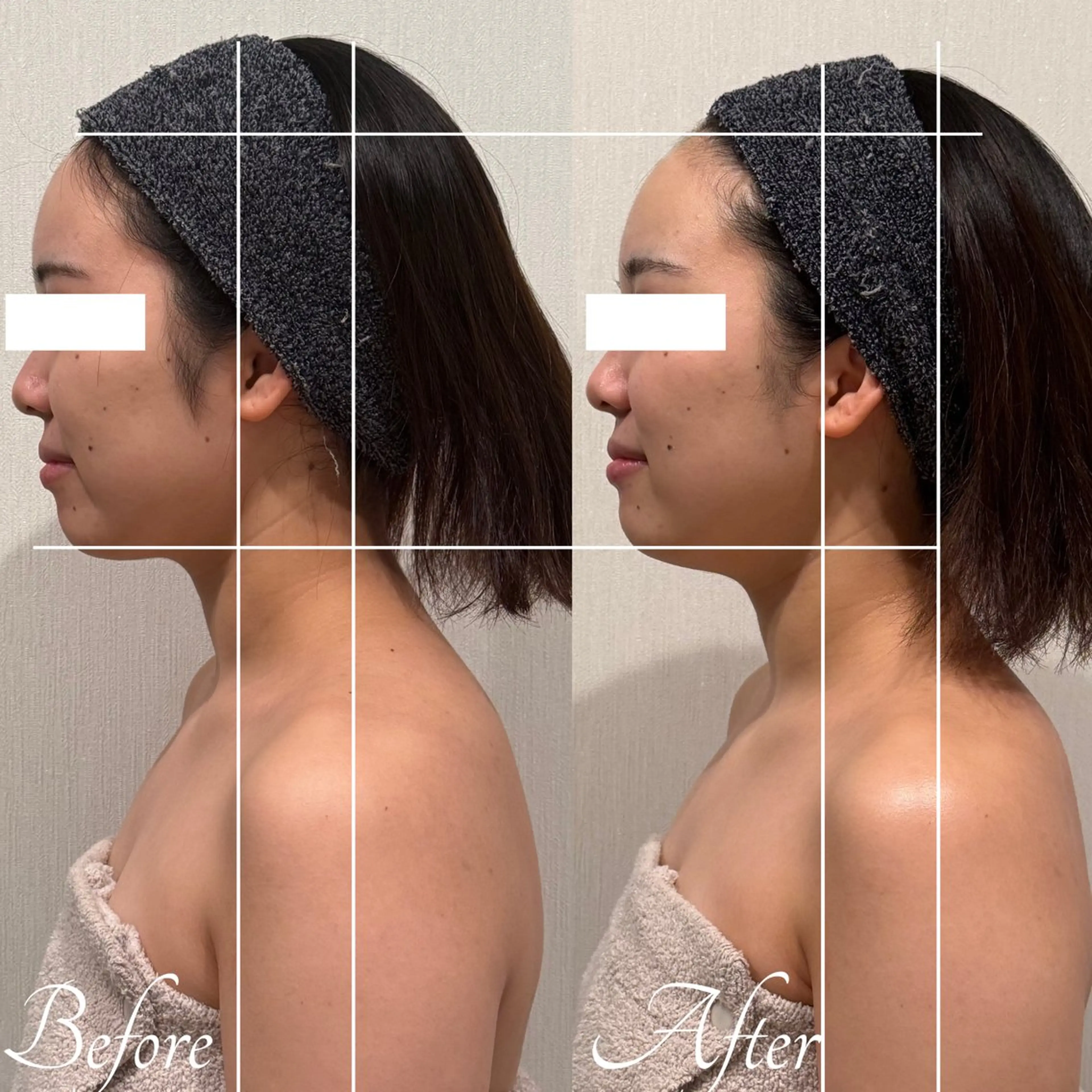 奇跡の体験✨華奢みえ小顔コルギ💆✨の写真