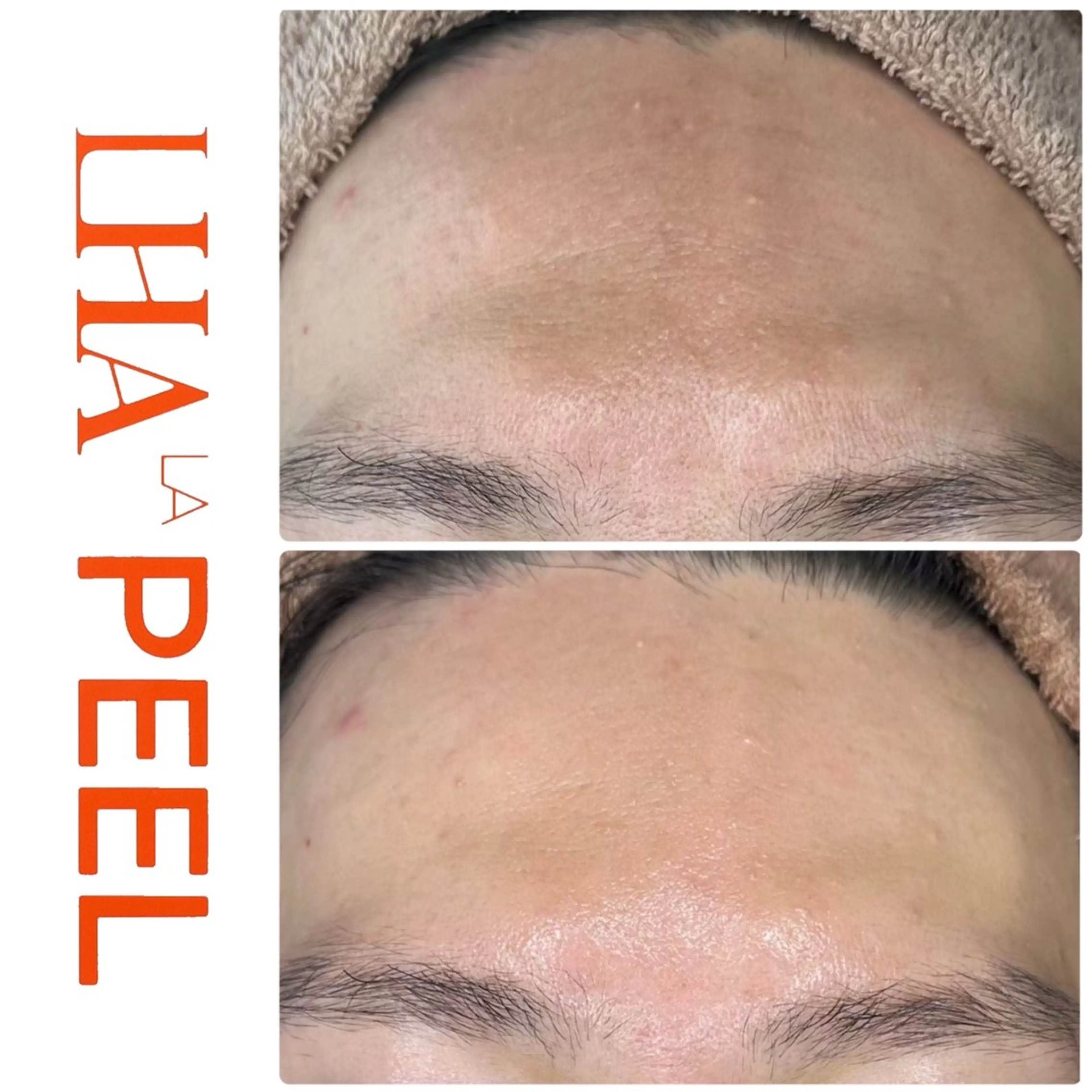 ハーブピーリング専門 BIOEL横浜のエステ・リラクイメージ