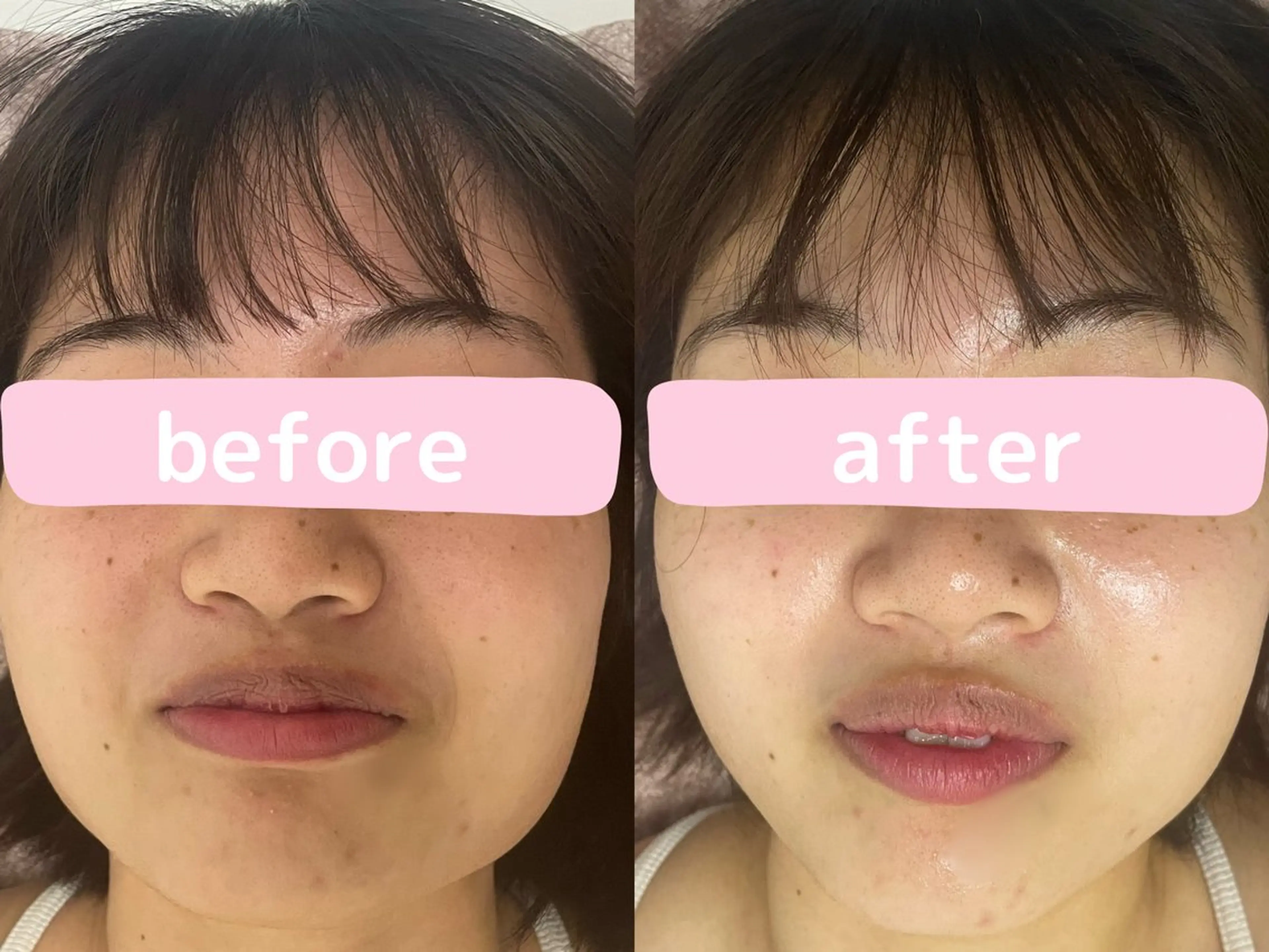 看護師が施術する 美容サロン/元治のエステ・リラクイメージ