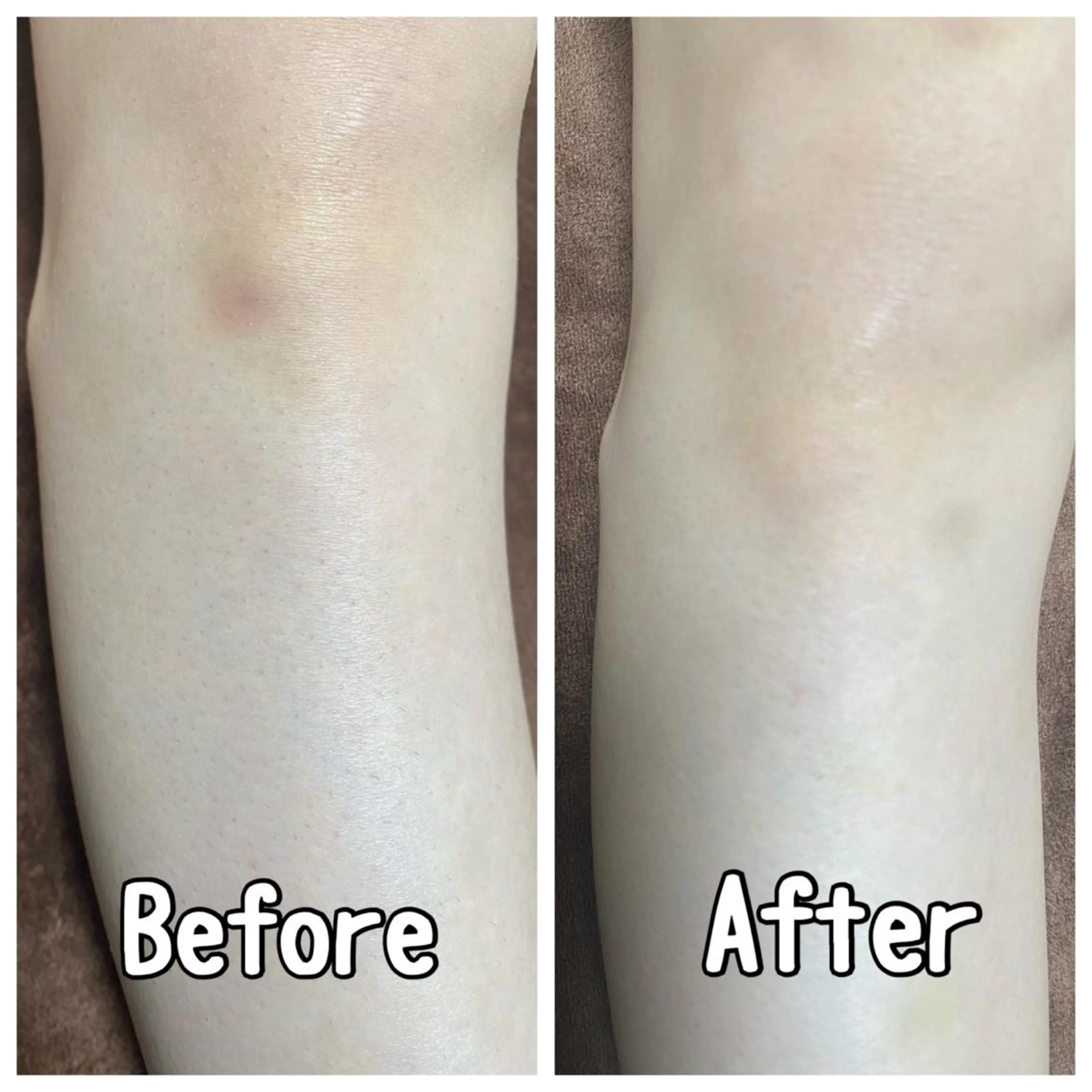 都度払い制脱毛サロンBe Charm所属・Be Charm 山﨑のエステ・リラクイメージ