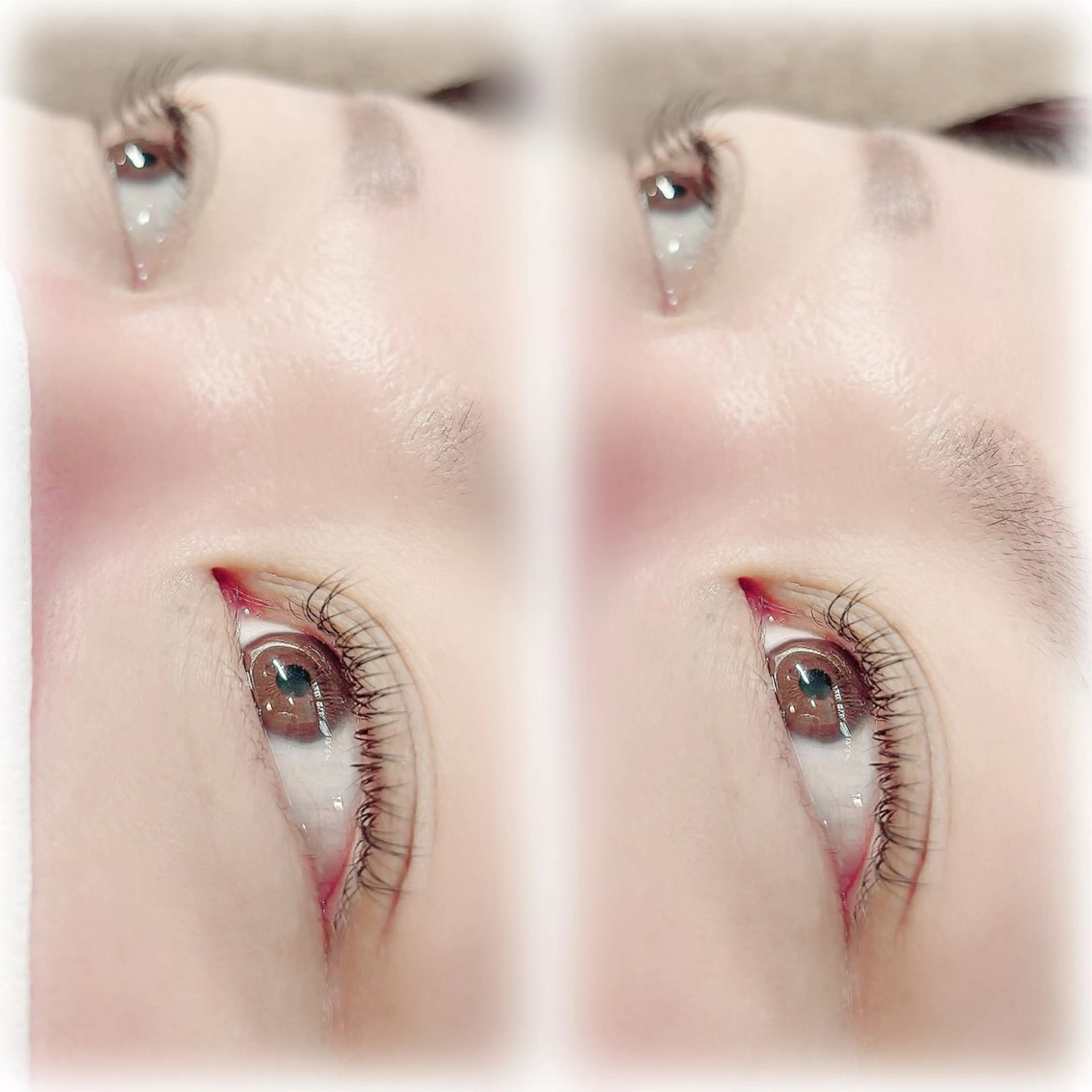 フラットラッシュ100本の写真