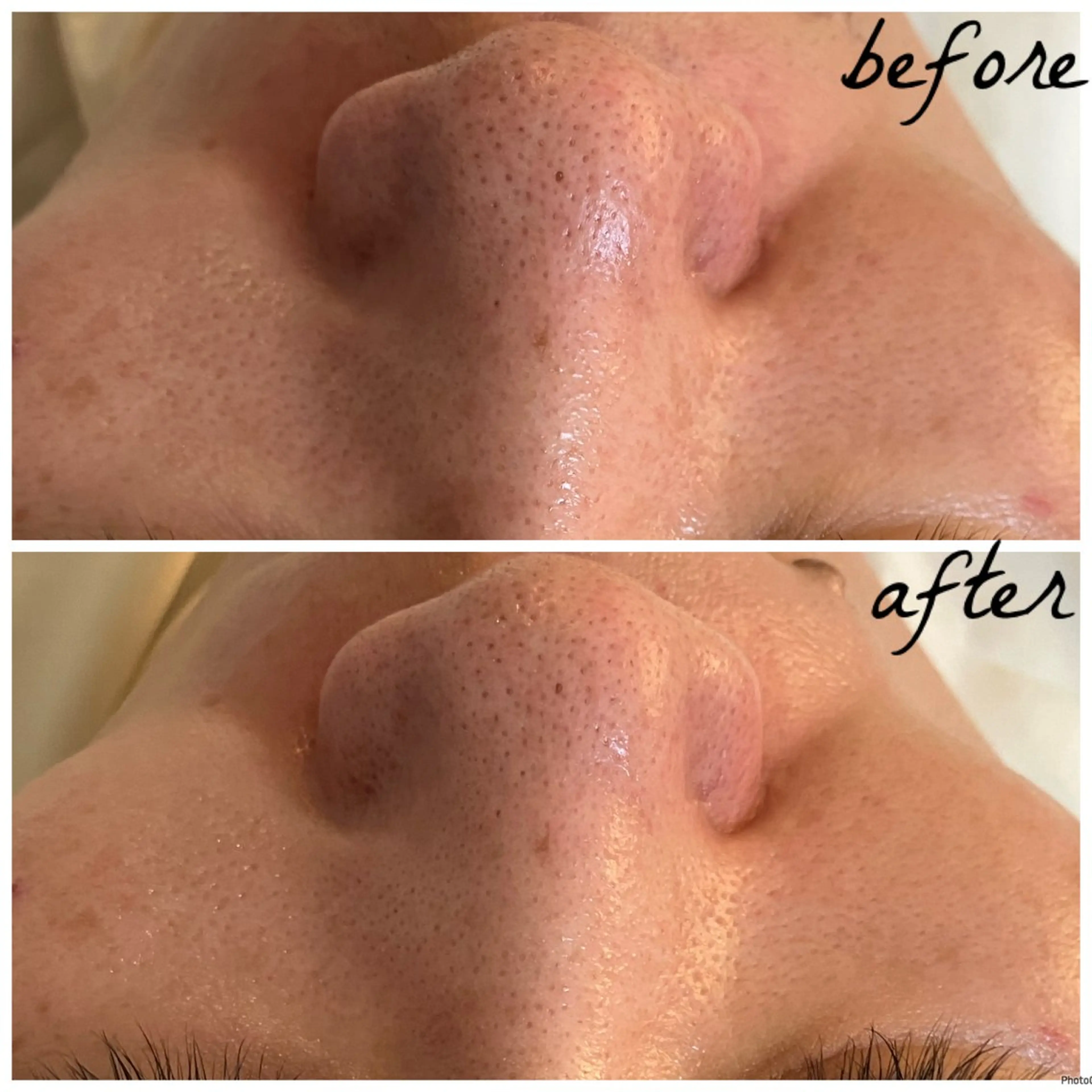 メンズ メナード岐阜茜部 杉浦のエステ・リラクイメージ