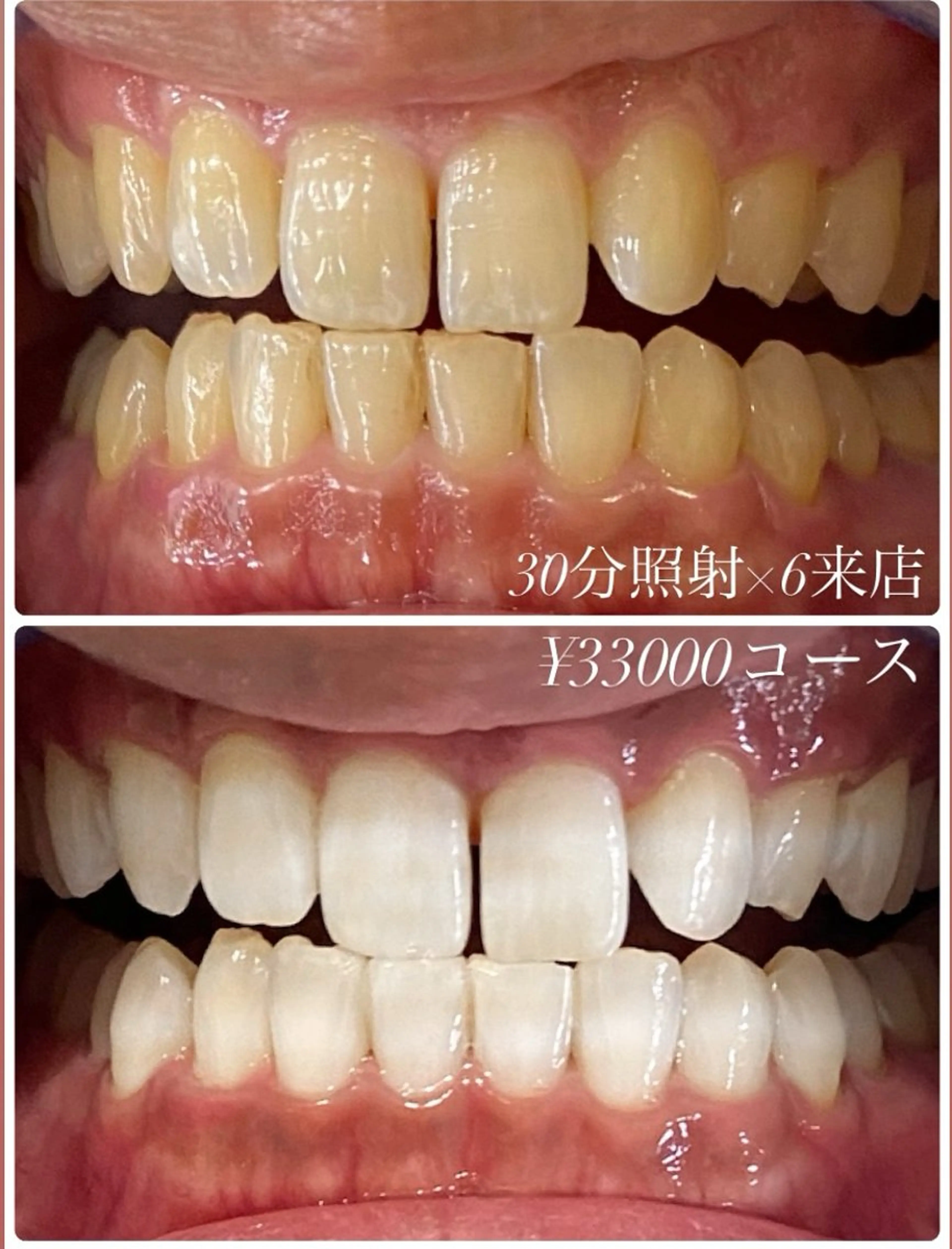 その他 ホワイトニングルーム　川崎店所属・ホワイトニング ルーム　川崎店のその他イメージ