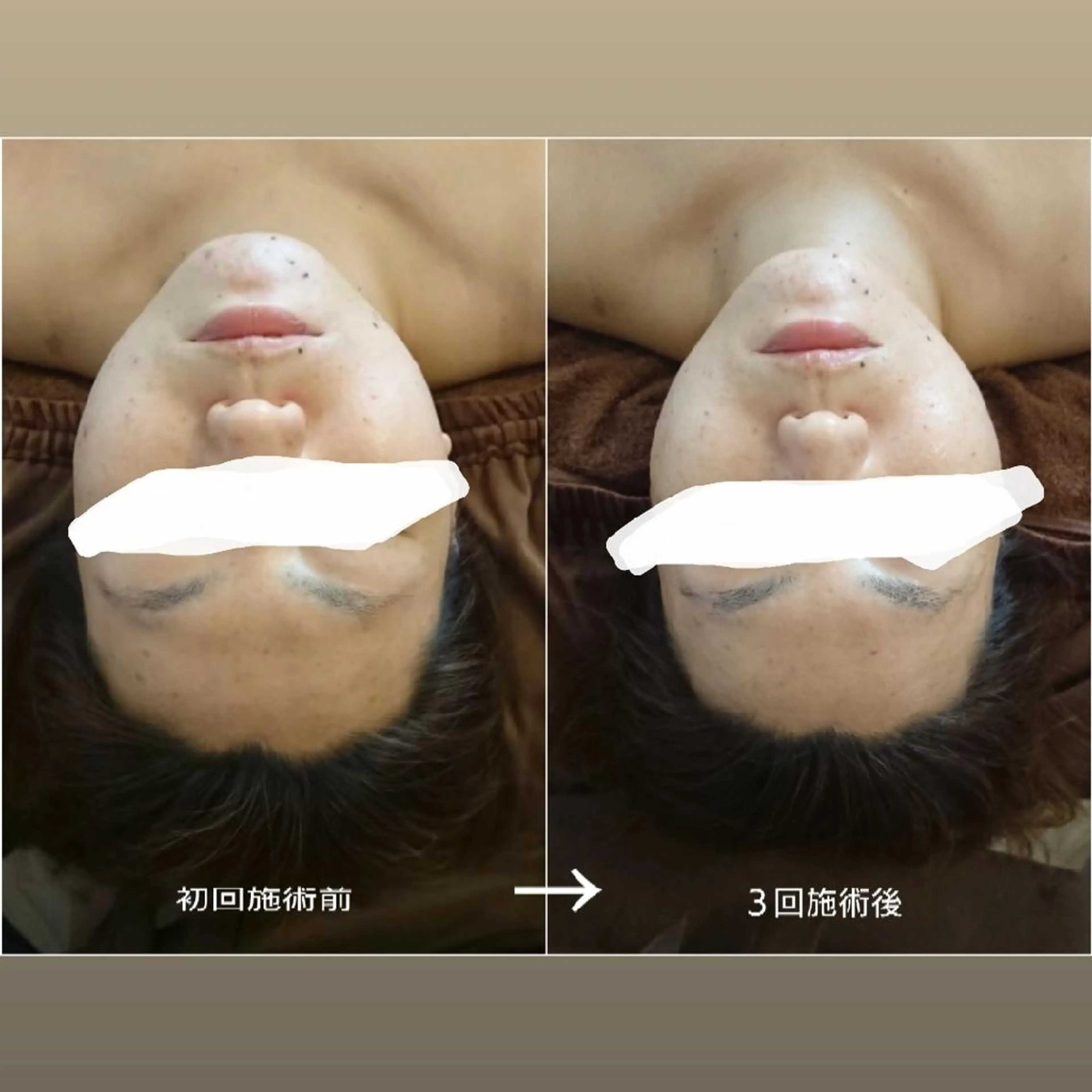 Jeliss~美爪育成ネイル＆頭蓋骨小顔矯正サロン~所属・美顔(小顔)矯正& 美爪育成Jelissのエステ・リラクイメージ