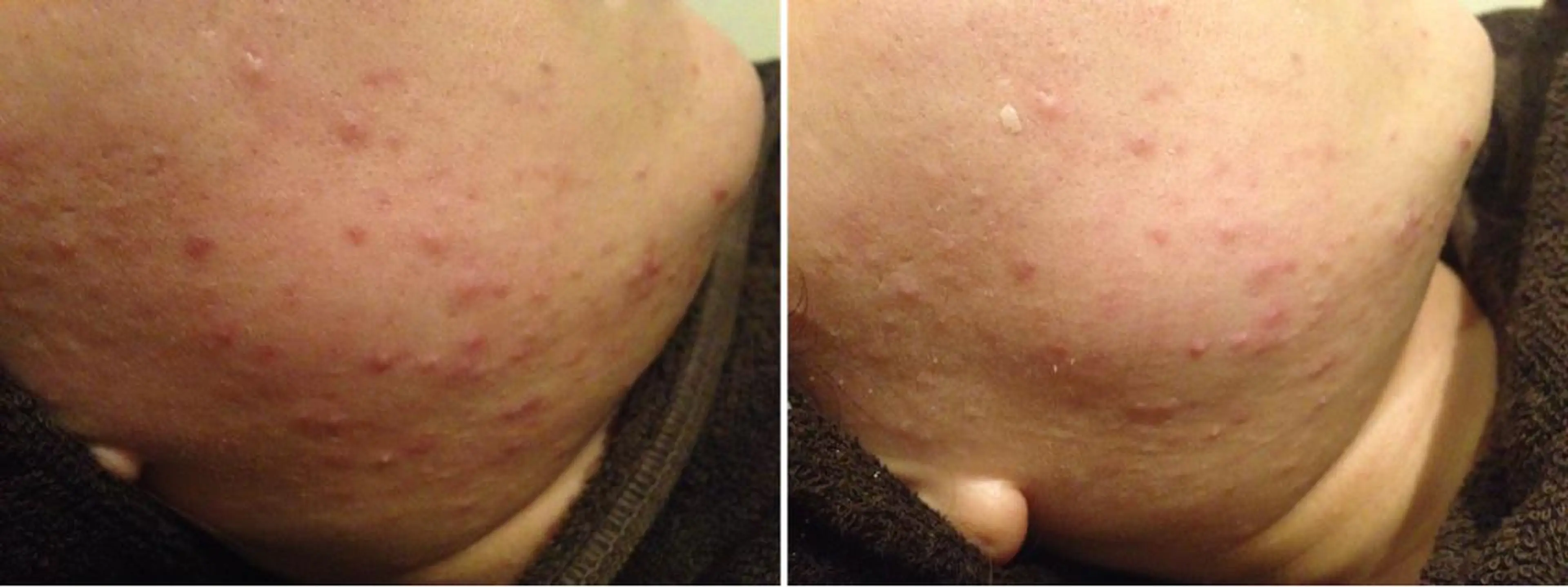 ロング カラー パーマ ヘアアレンジ メンズ キッズ ネイル マツエク・マツパ 赤色 アニメ,Vオタク× 即効痩せエステサロンのエステ・リラクイメージ