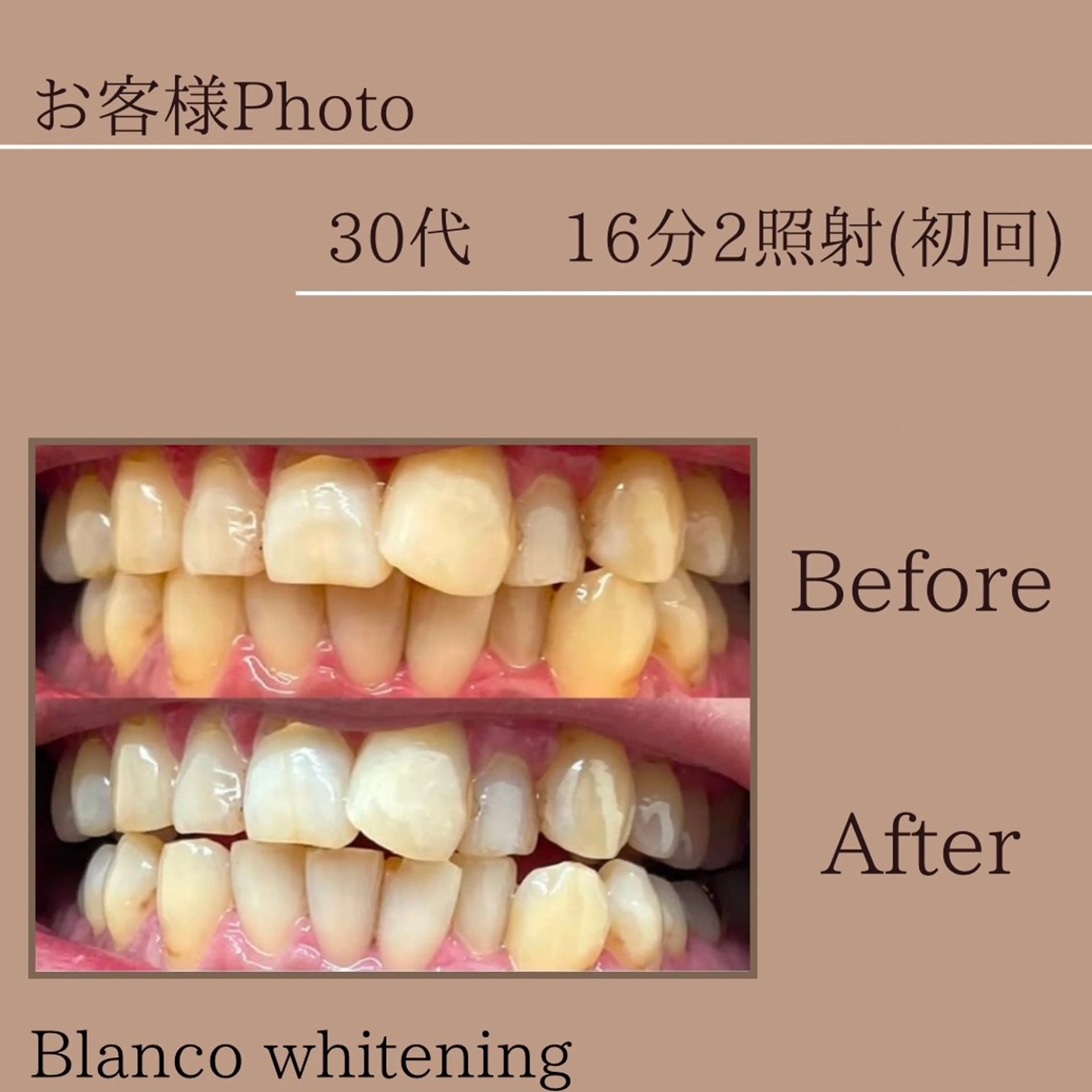 Blanco東大宮駅前店所属・blanco 東大宮駅前店のその他イメージ