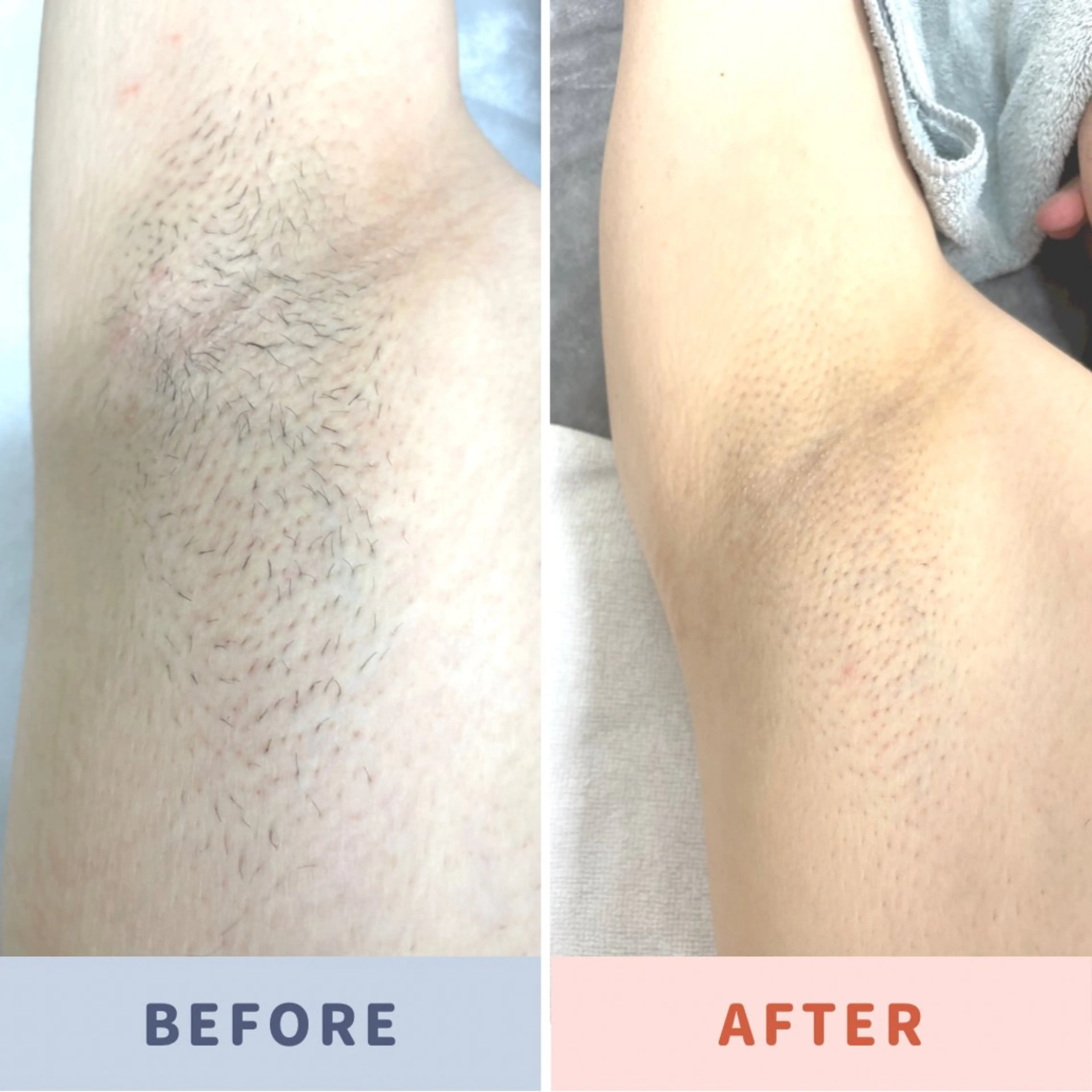 dion.kobe所属・脱毛リラグゼーション dion.kobeのエステ・リラクイメージ