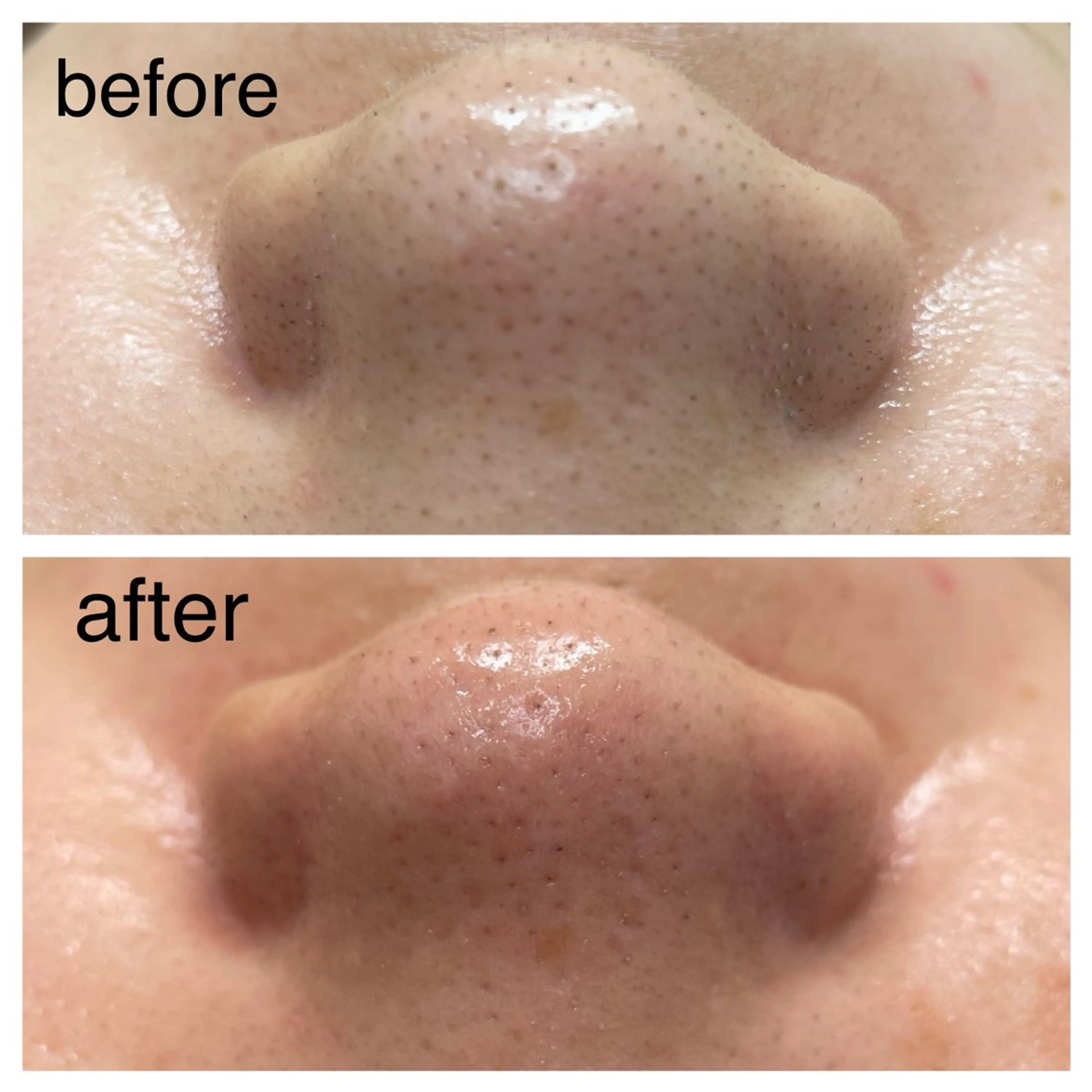 その他 Reid-月詠-所属・Reid -月詠-のエステ・リラクイメージ