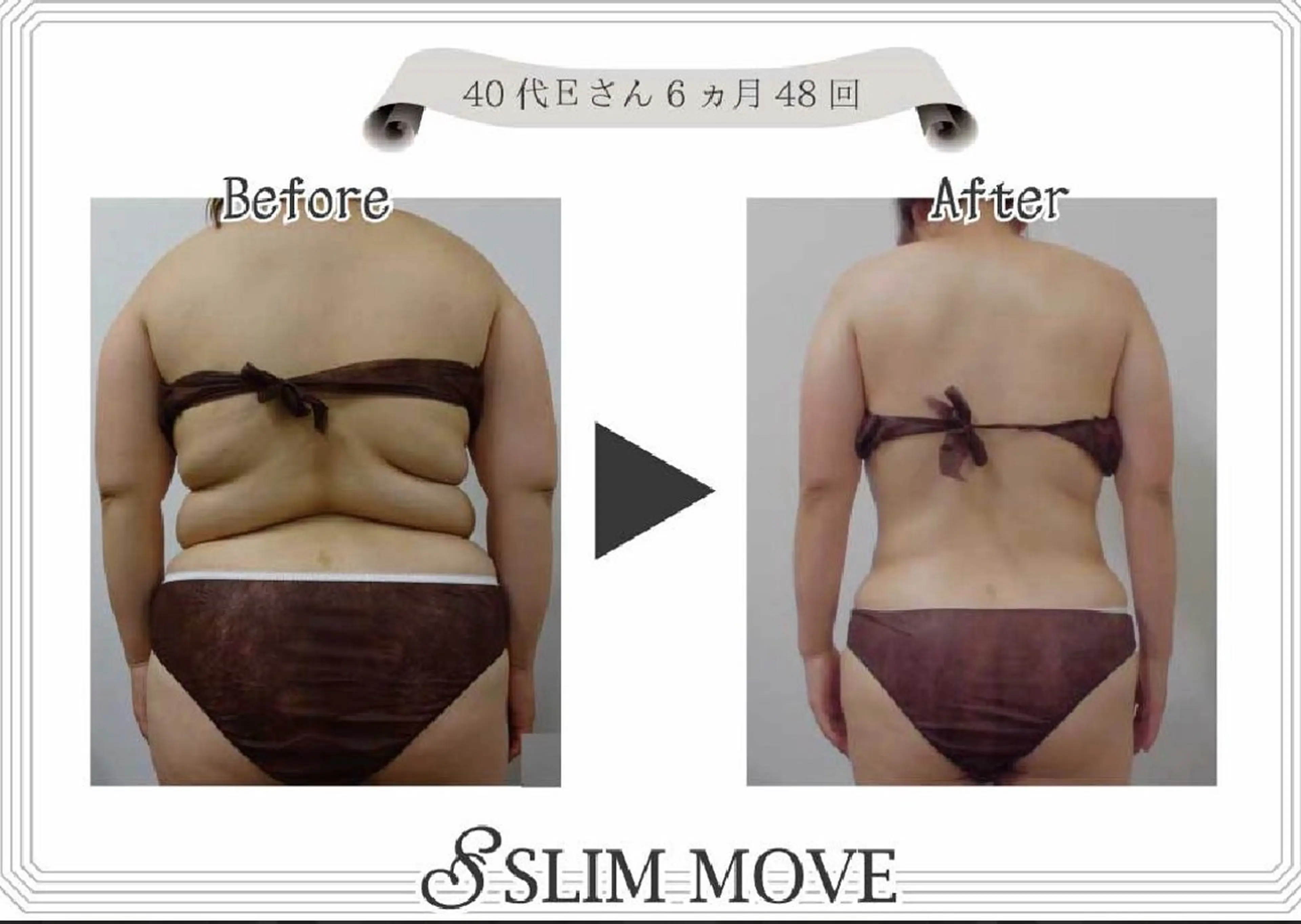 エルモサ痩身脱毛 西八王子店のエステ・リラクイメージ