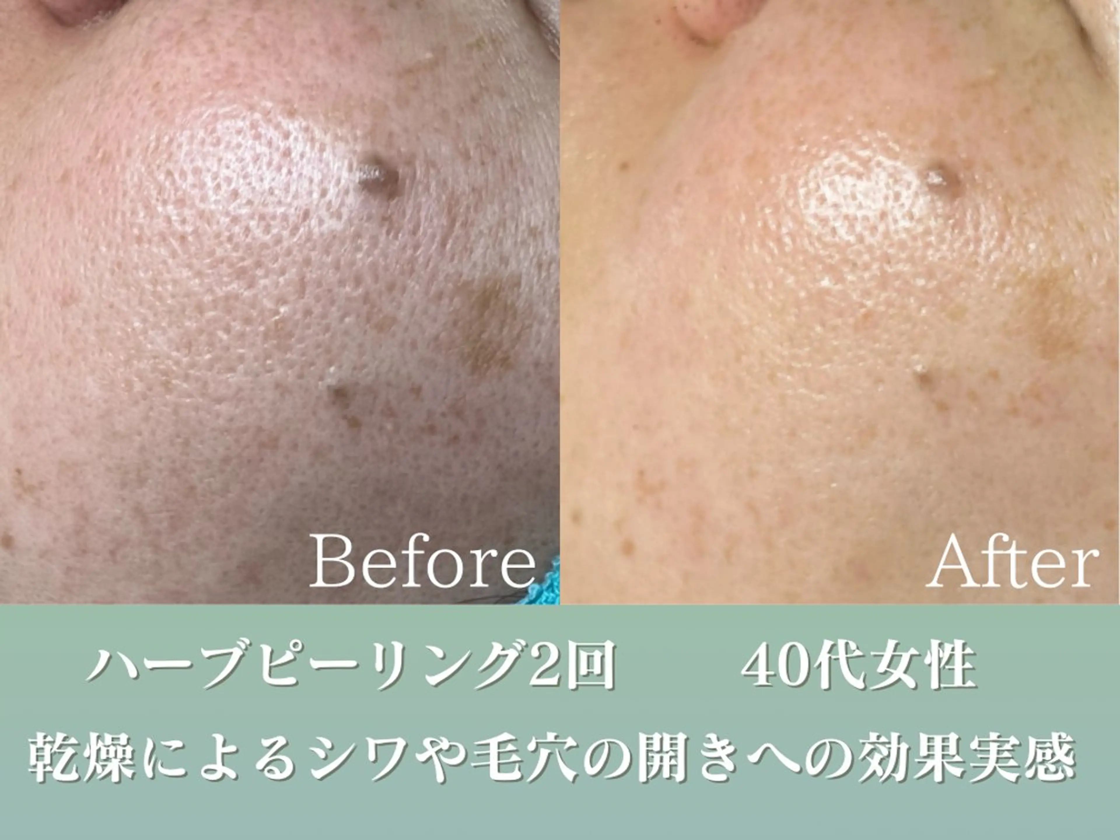 潤い艶肌／肌質改善 YUKAのエステ・リラクイメージ