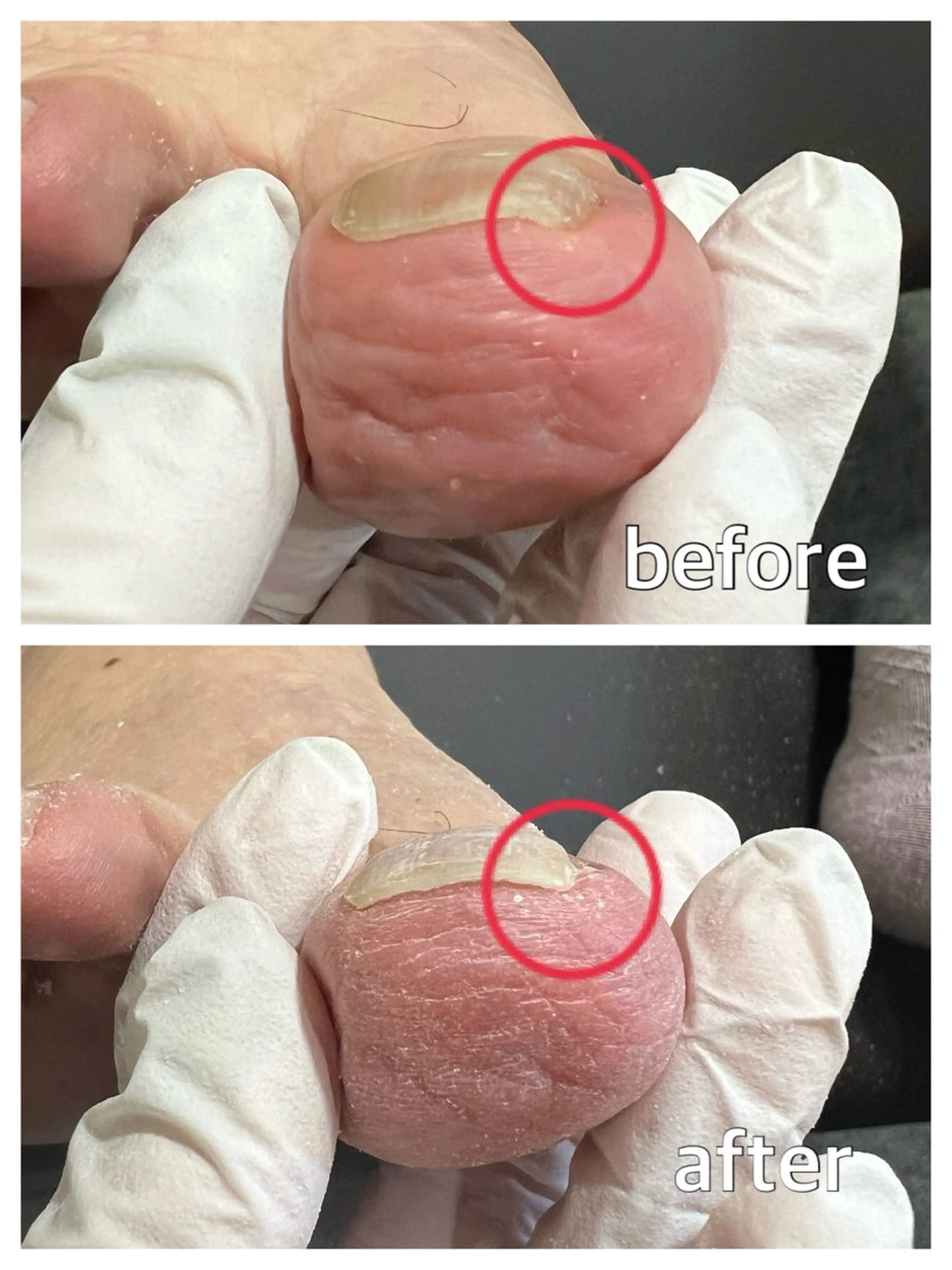 ネイル フットネイル 巻き爪補正店 堺東店のネイルデザイン