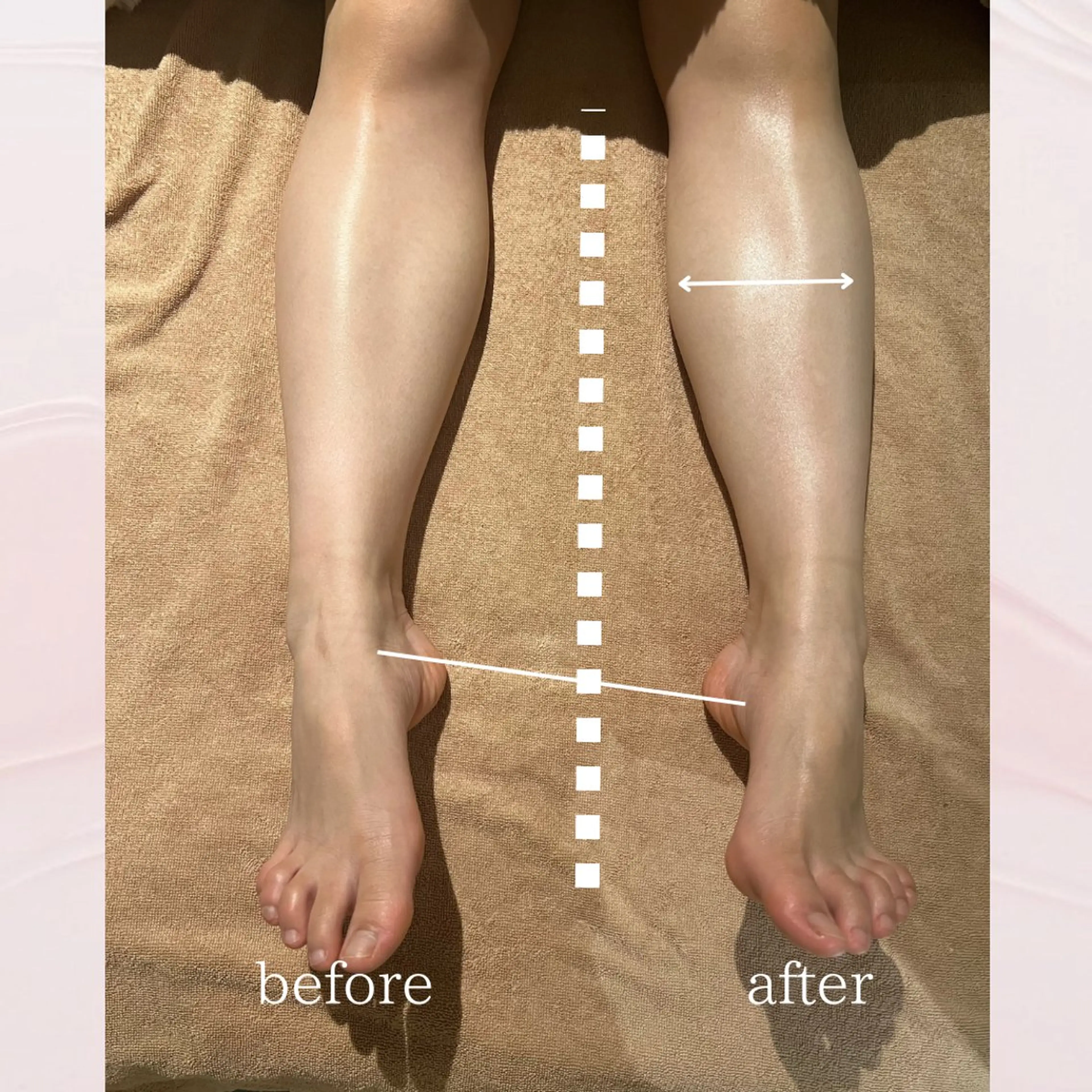 エステ リラク 【vidyto】ヴィディトゥ所属・肌管理サロン vidyto　MOEのエステ・リラクイメージ