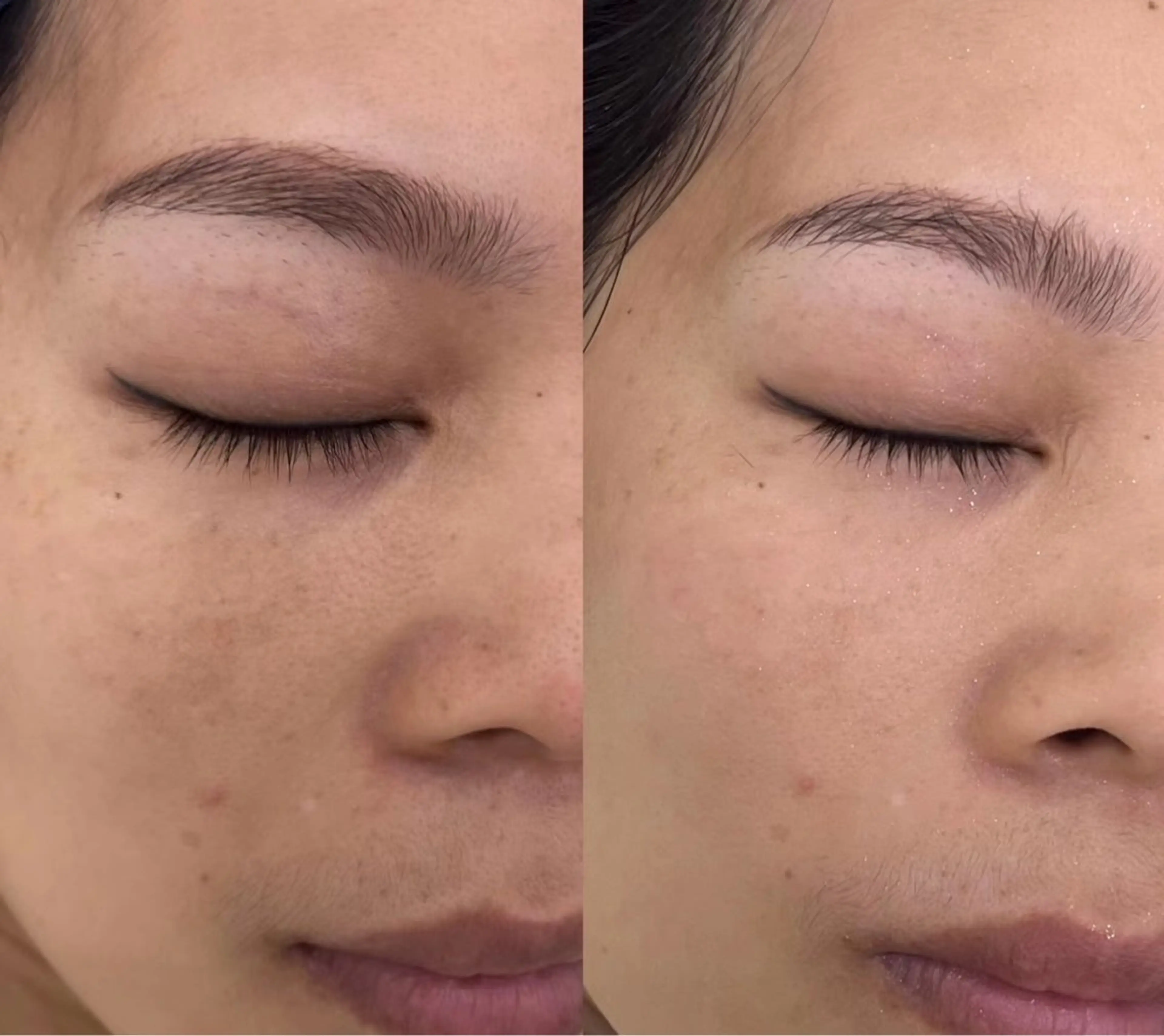 エステ リラク 愛維美水光美肌専門店所属・愛維美水光美肌専門店 メンズレディースokのエステ・リラクイメージ