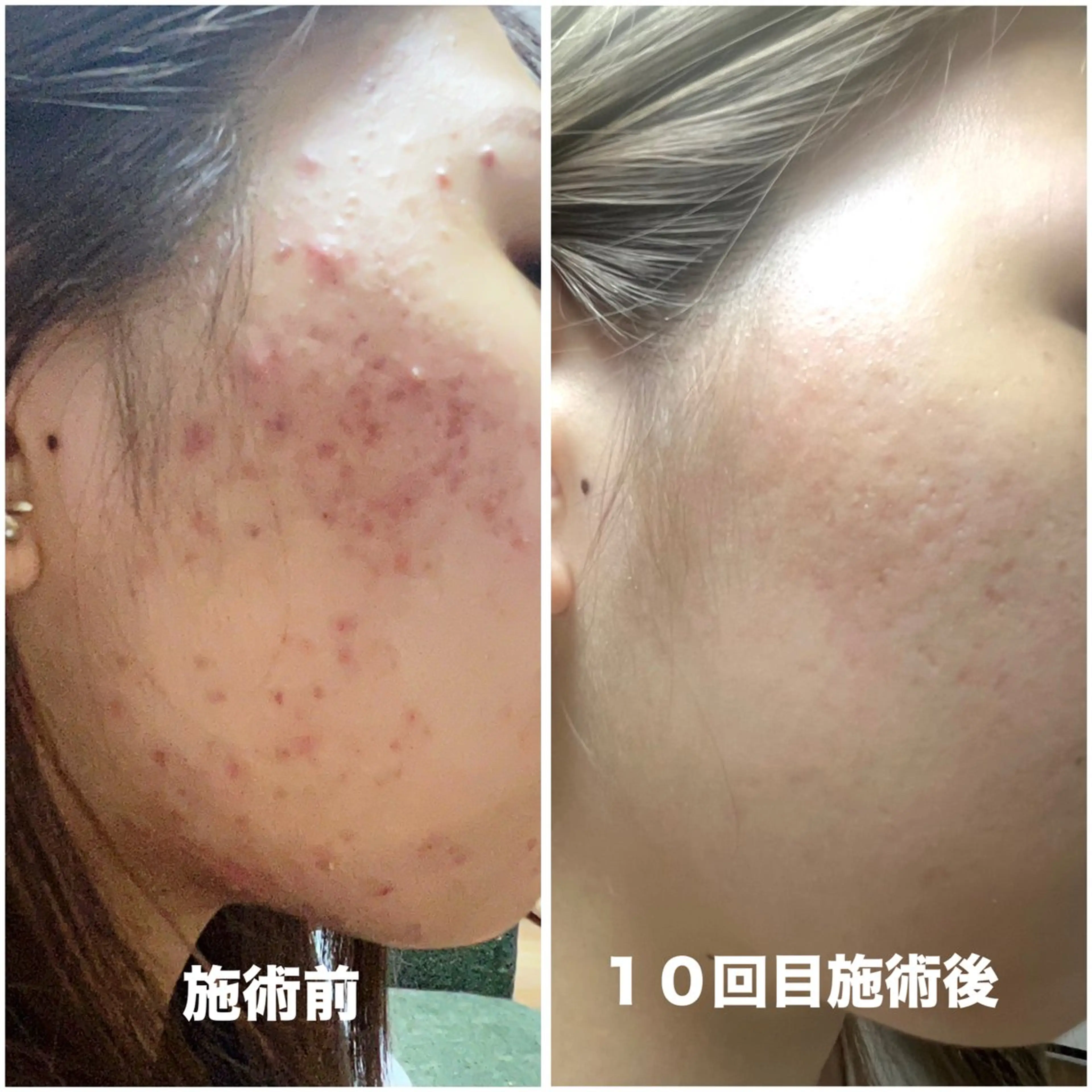 スリーエスプラス内　美肌サロンEme所属・希映 -kieのエステ・リラクイメージ