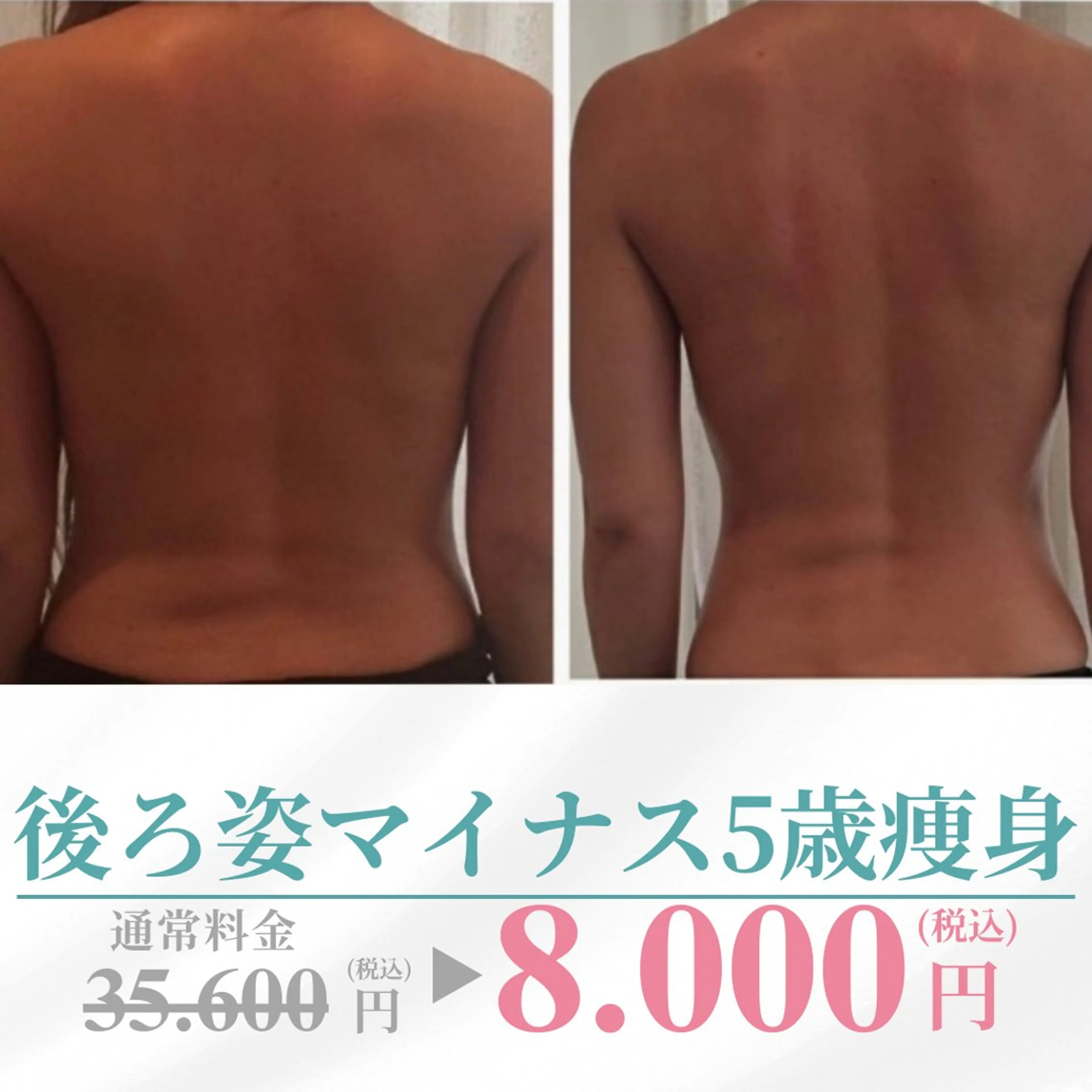 【二の腕・背中美ライン90分1回痩身】たるみ撃退で細見えボディ！ドレス映え・姿勢美人ケア✨️ブライダルにもおすすめの写真