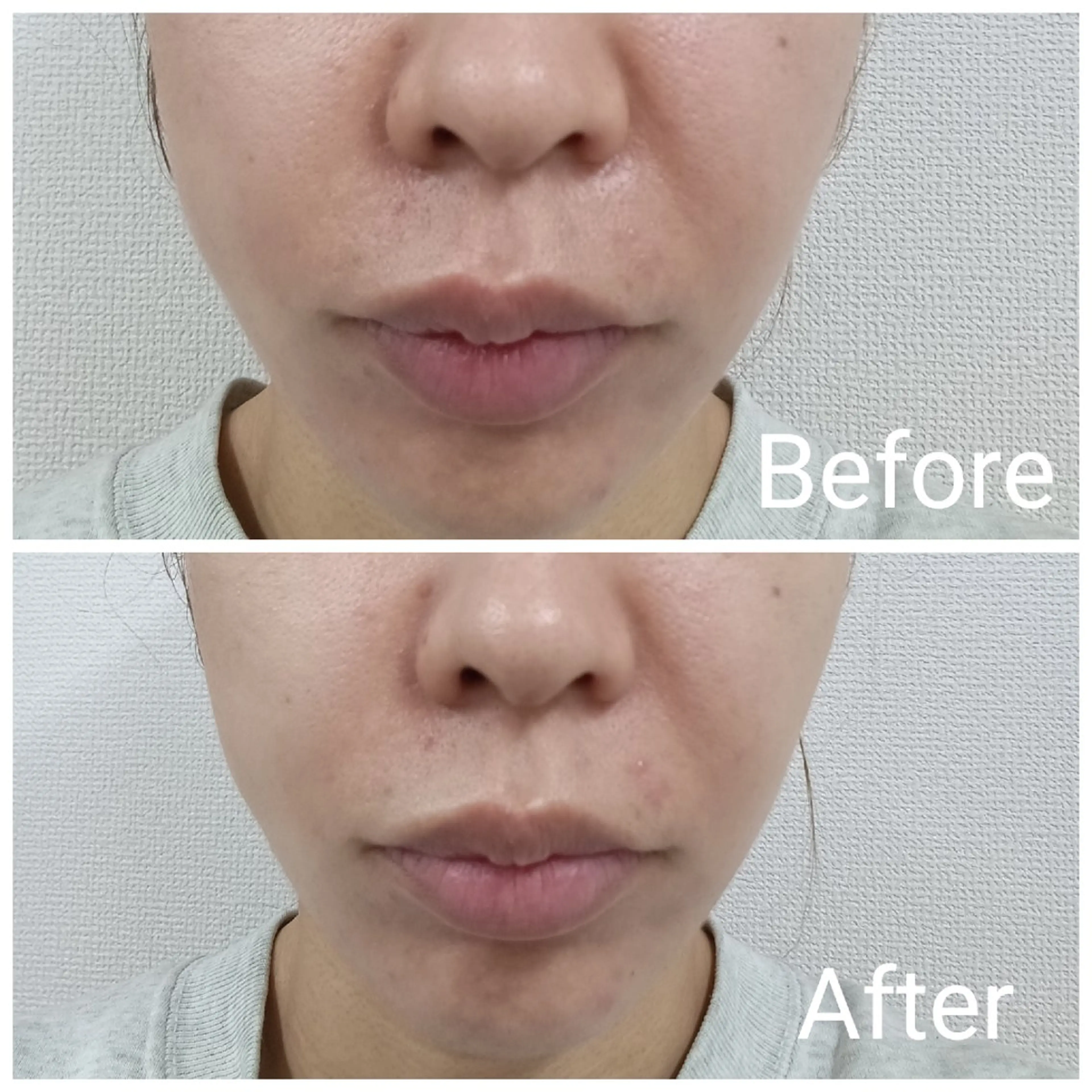 エステ リラク 肌質改善Beauty salon Renのエステ・リラクイメージ