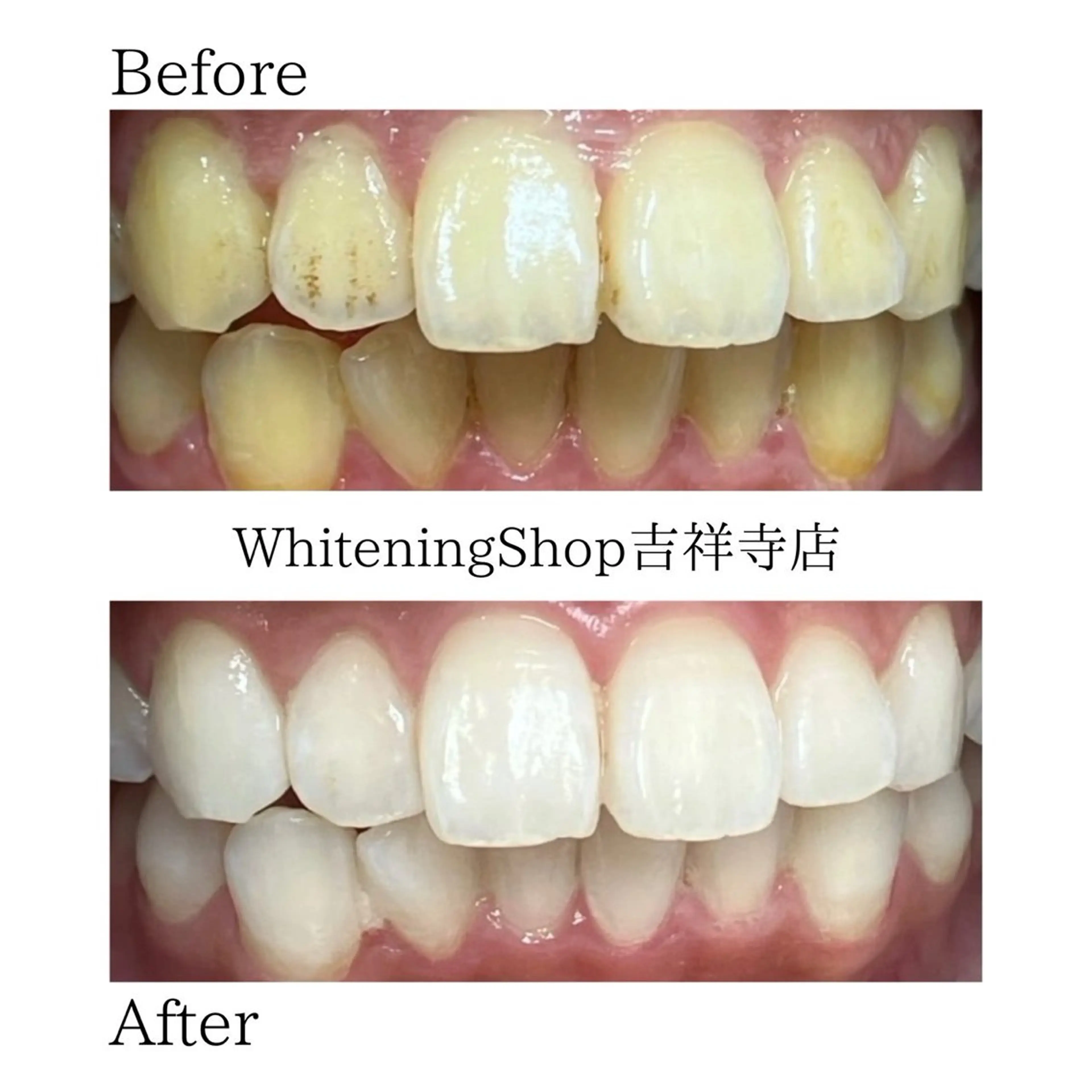 エステ リラク ホワイトニング ショップ吉祥寺店のエステ・リラクイメージ