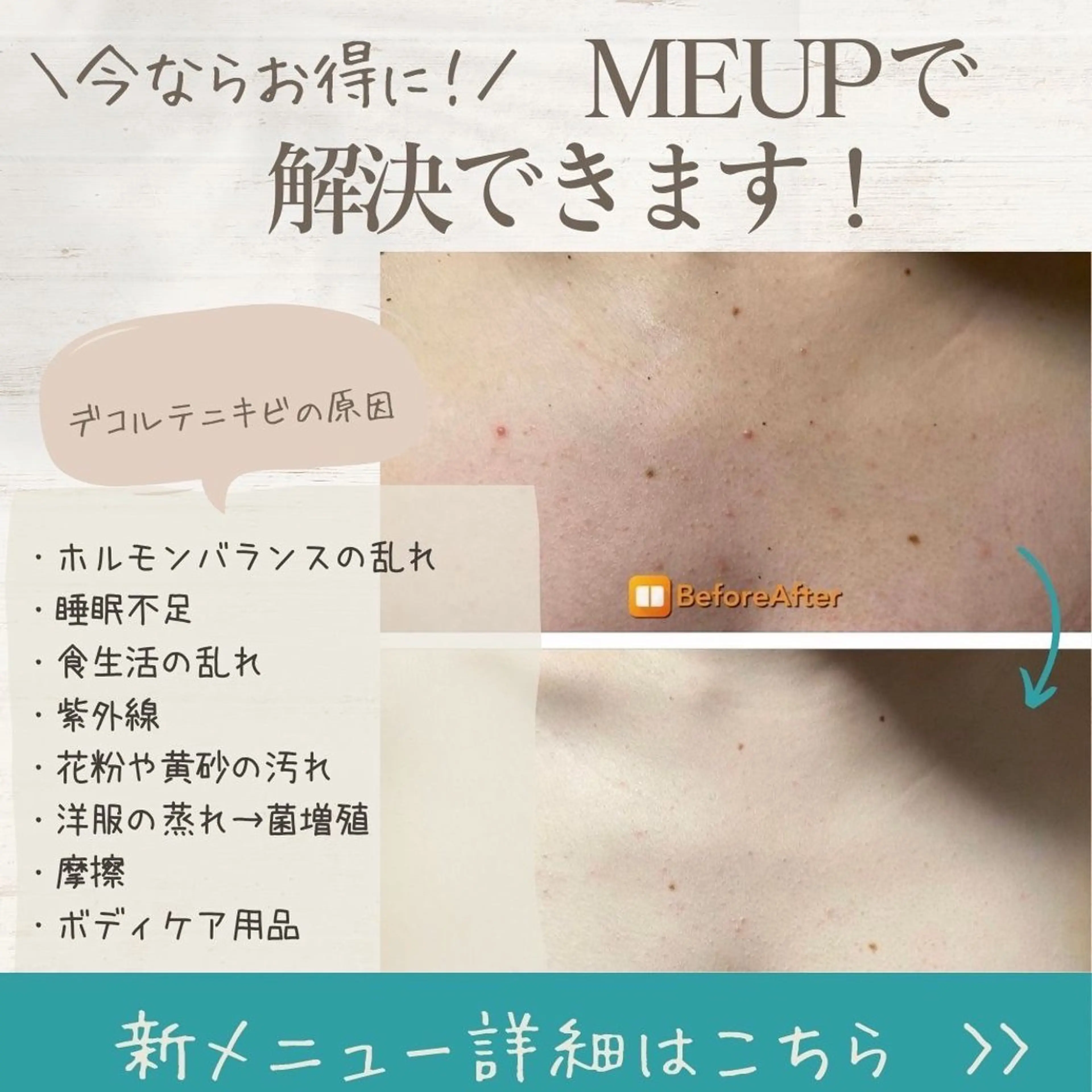 Meupニキビ専門店 背中/ハーブ/肌管理のその他イメージ