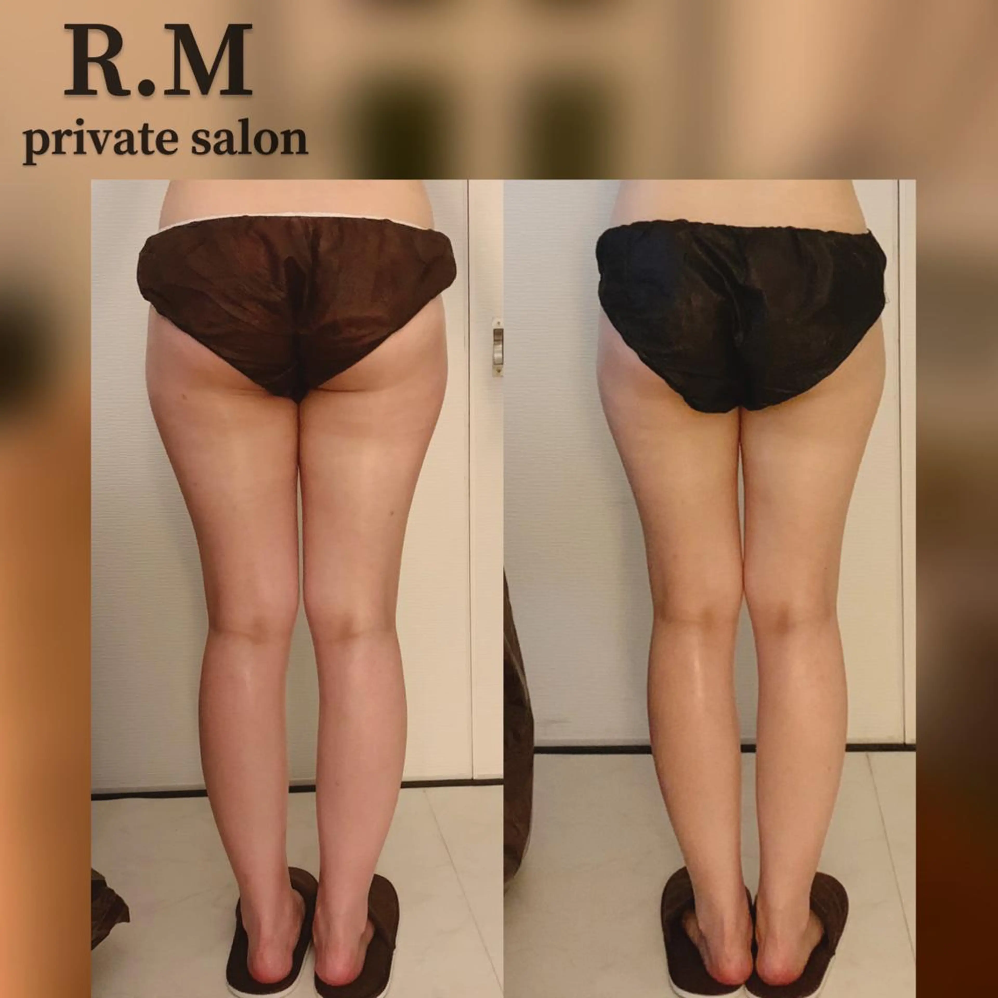 R.M所属・プライベートサロン R.Mのエステ・リラクイメージ