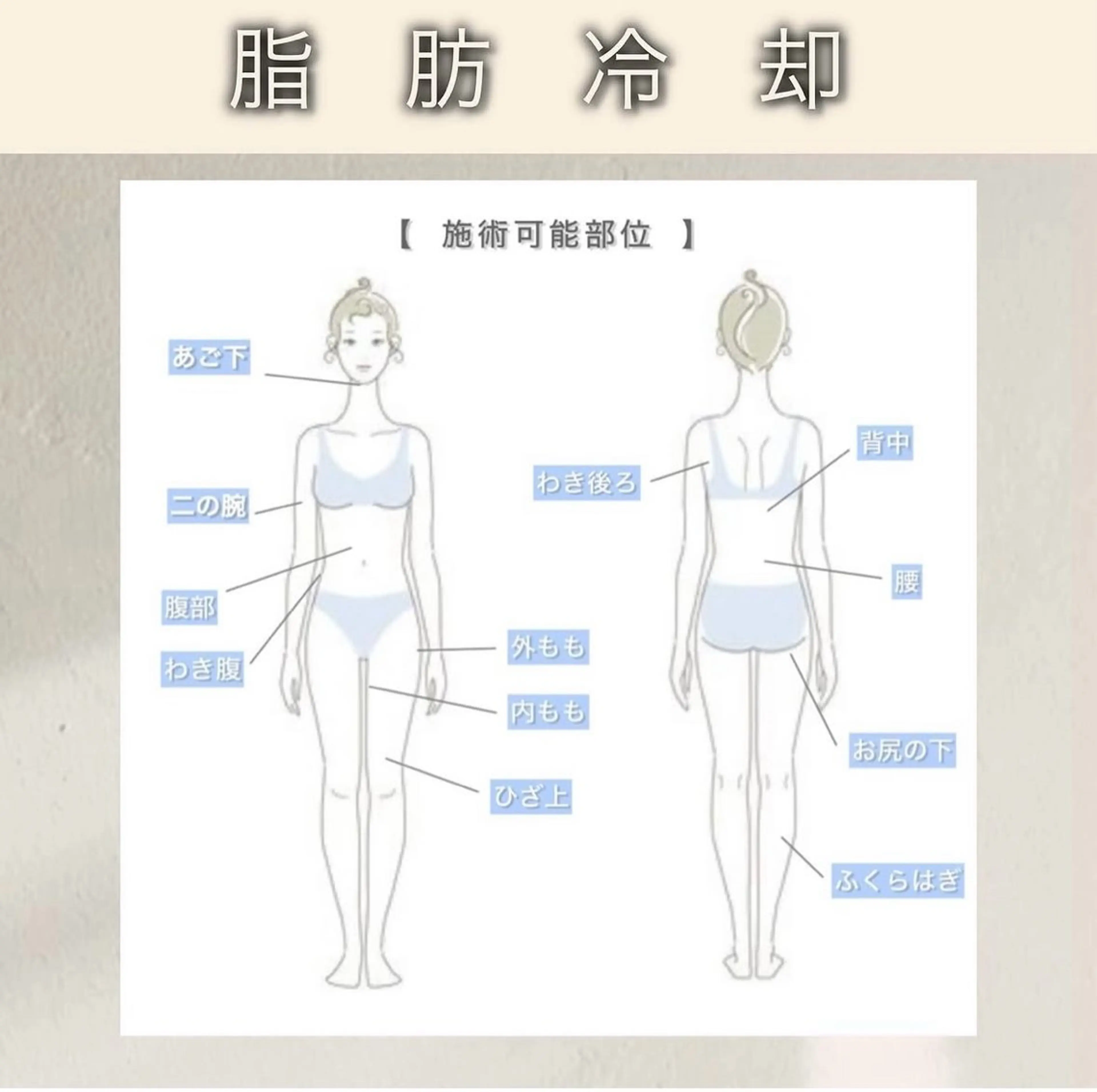 期間限定価格！お好きな痩身4部位をお選びいただける冷却施術！の写真