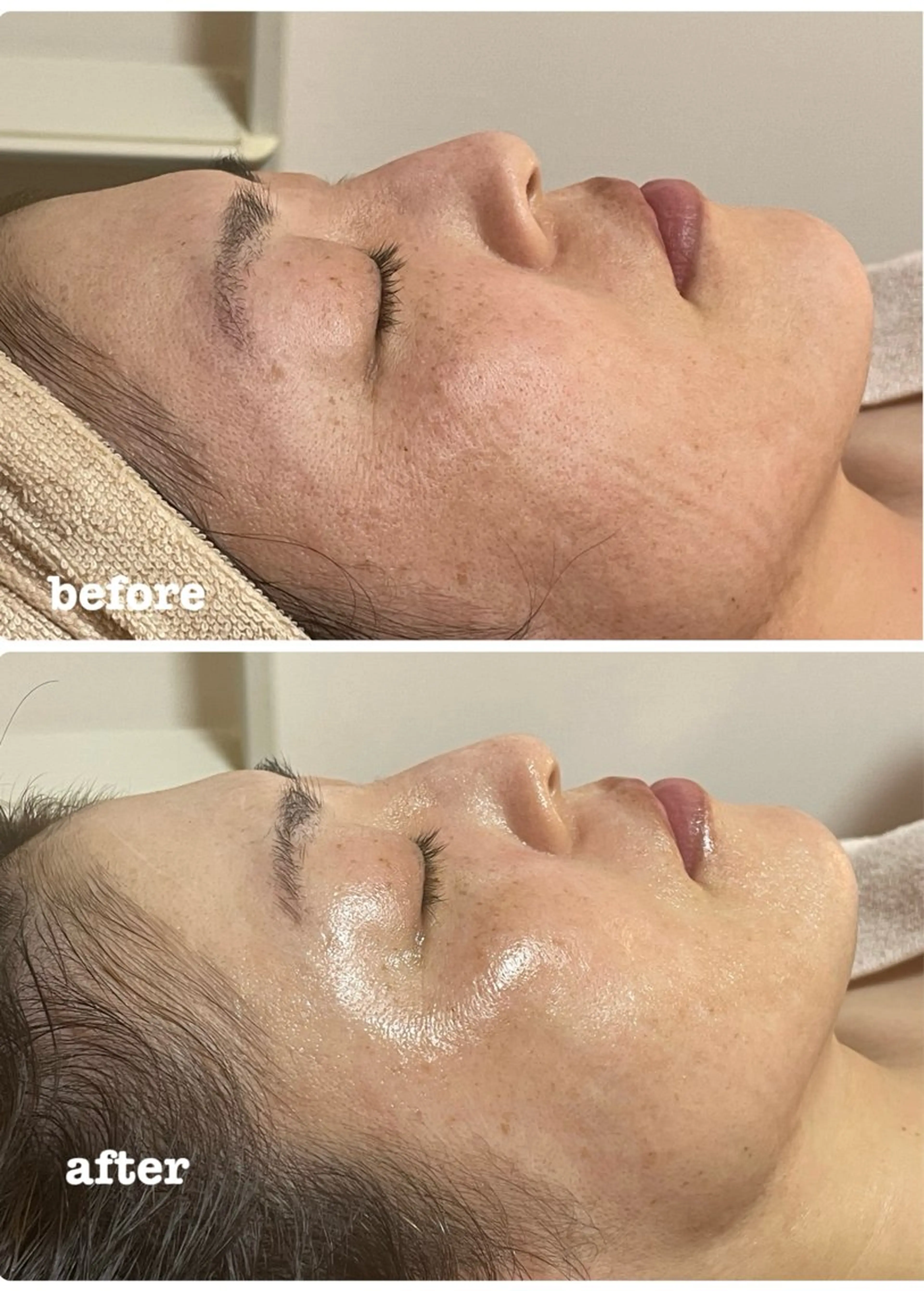 エステ 肌質改善専門店/絹々(きぬ)所属・心満たされる ハーブピーリング絹々のエステ・リラクイメージ