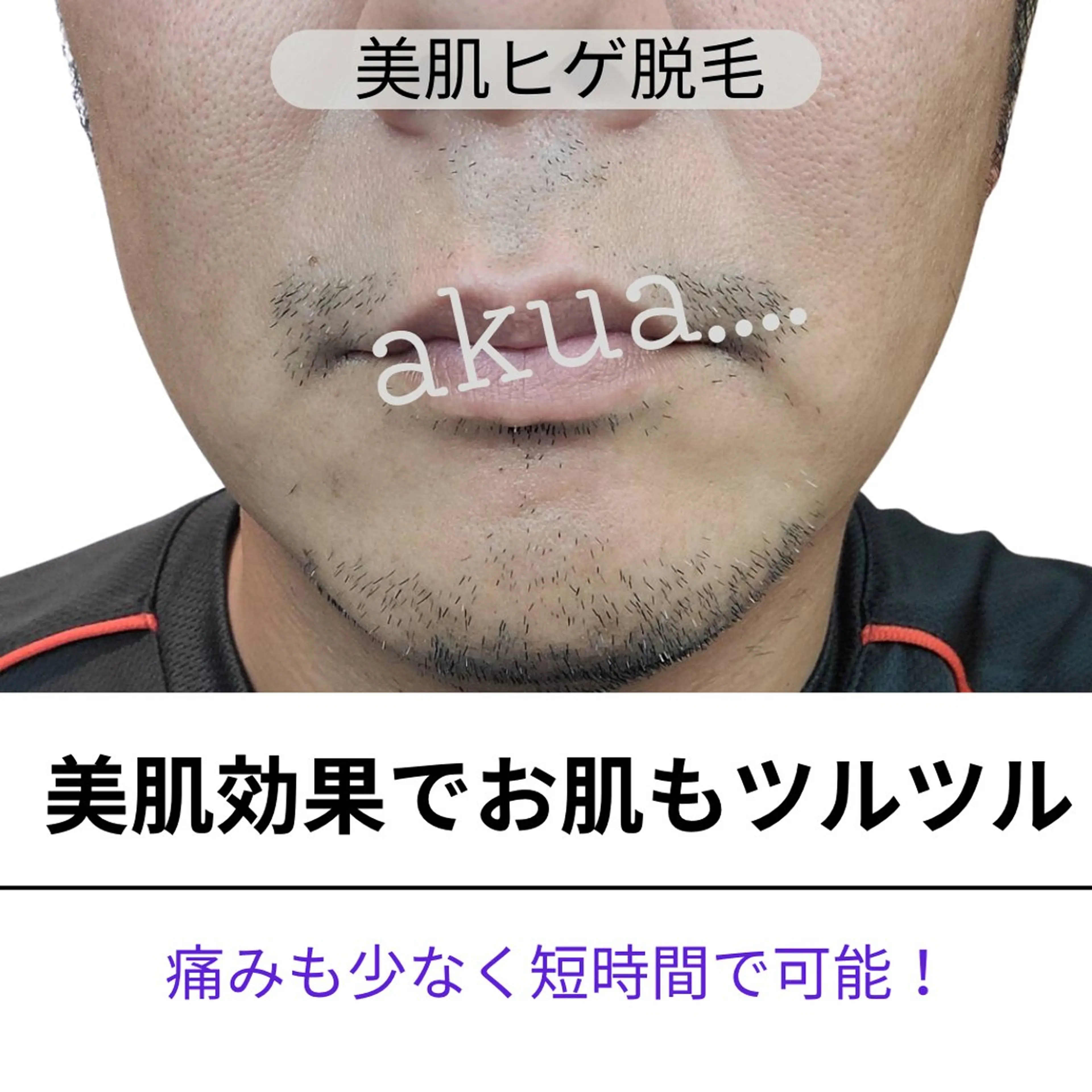 akua... 【肌質管理専門】のその他イメージ