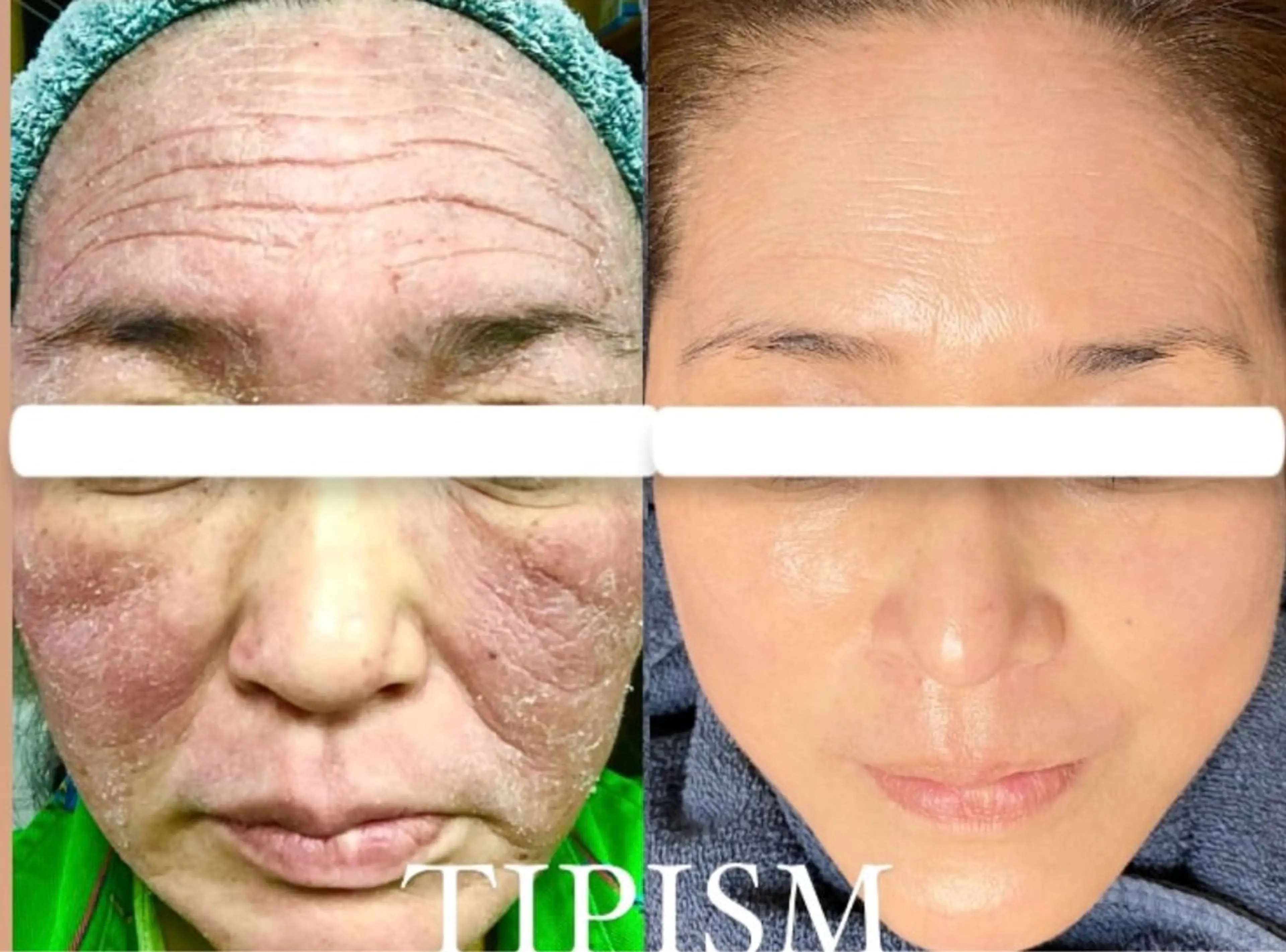 Ellebeauty relaxationのエステ・リラクイメージ