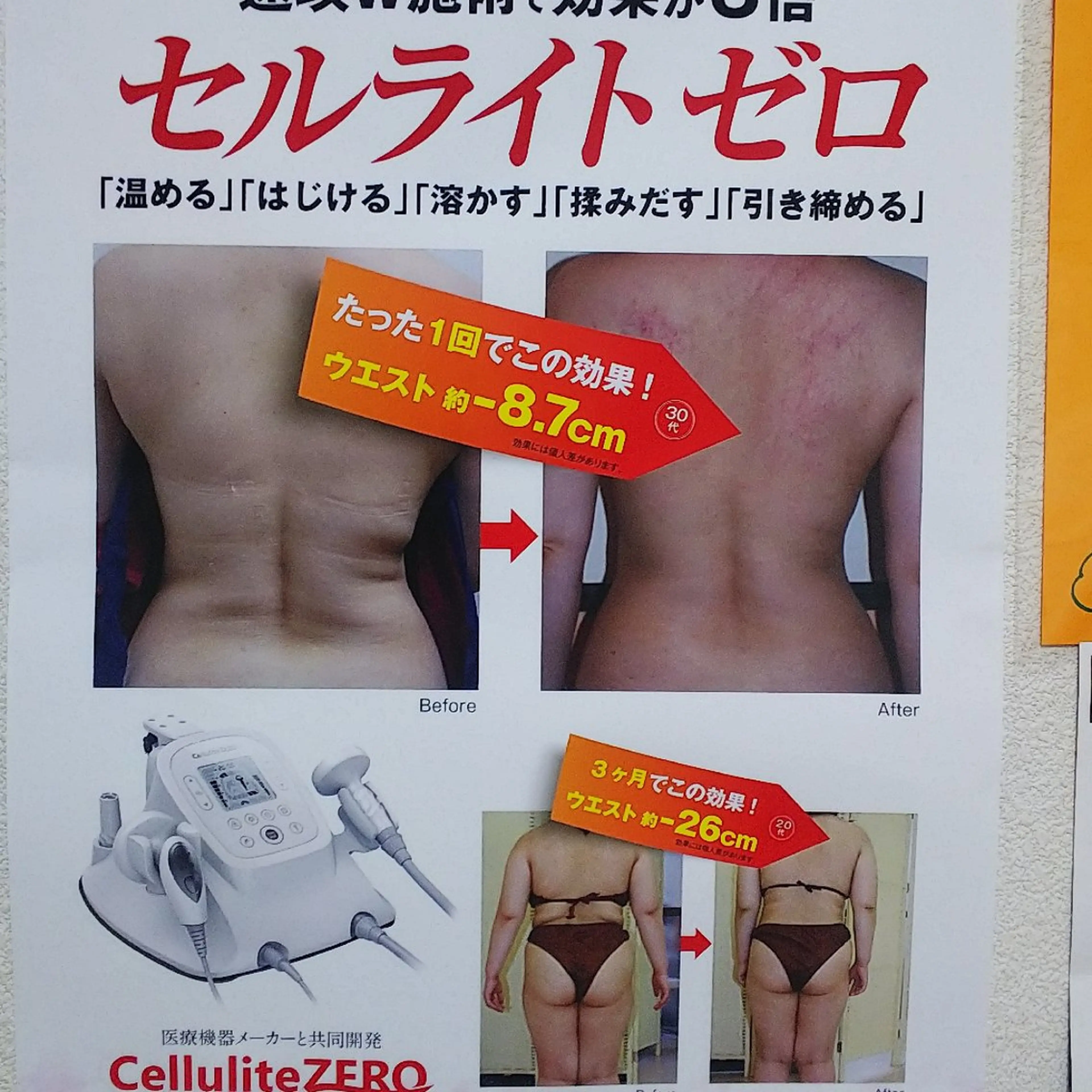 （初回限定お試し）１代5役のセルライトゼロの写真