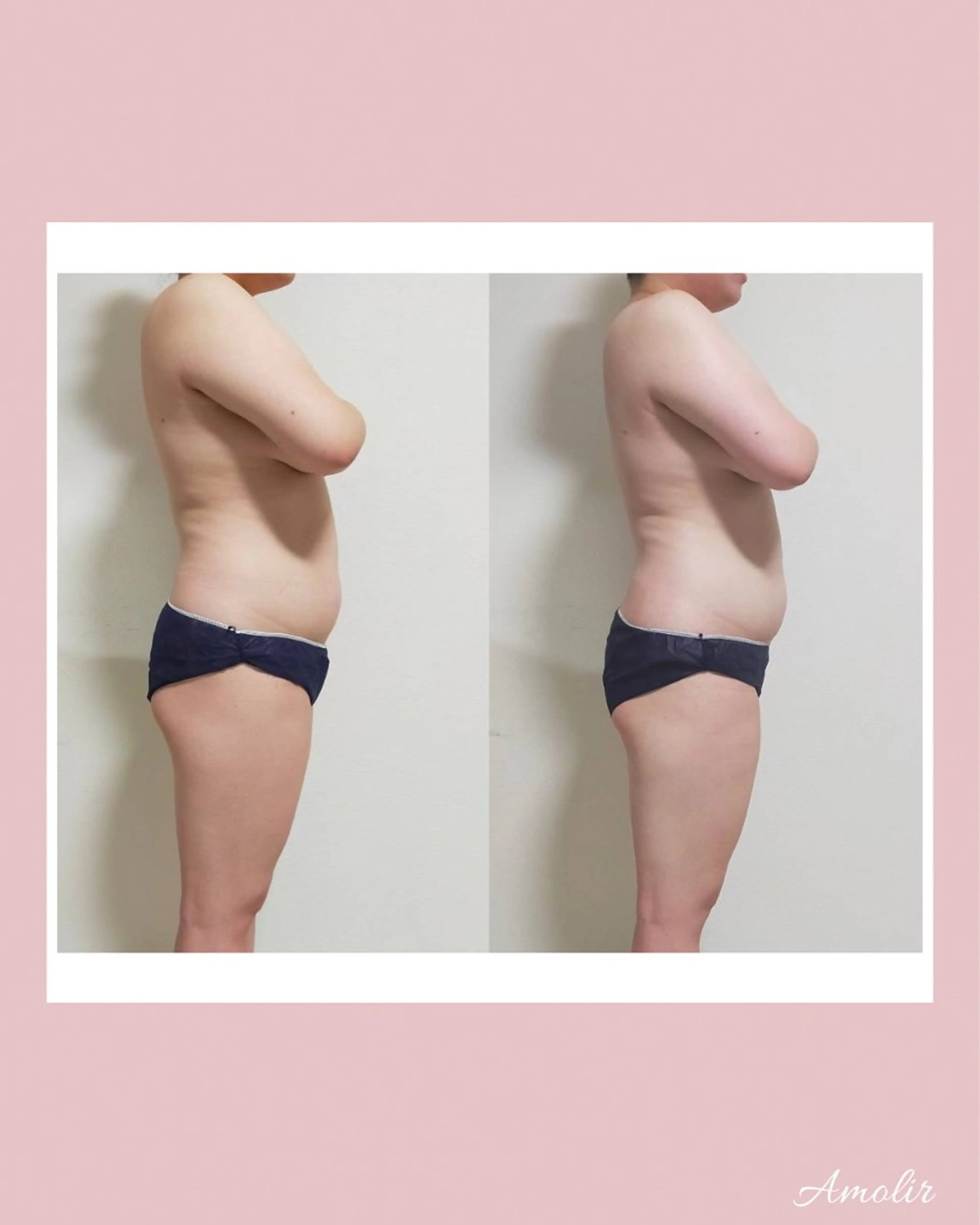 30代以降のボディ メイク Amolirのエステ・リラクイメージ