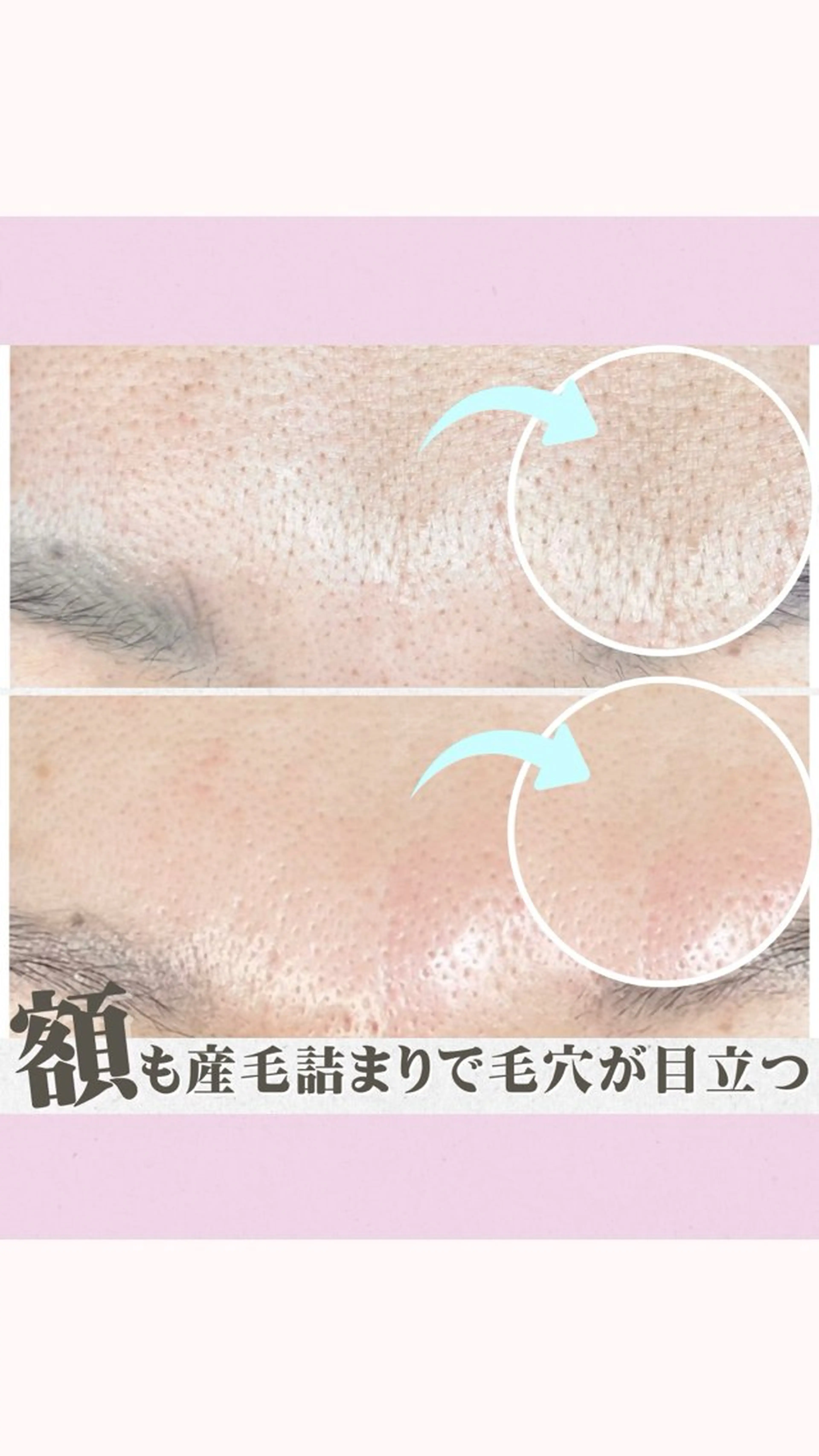 エステ Muqu.所属・Muqu. 毛穴サロンのエステ・リラクイメージ