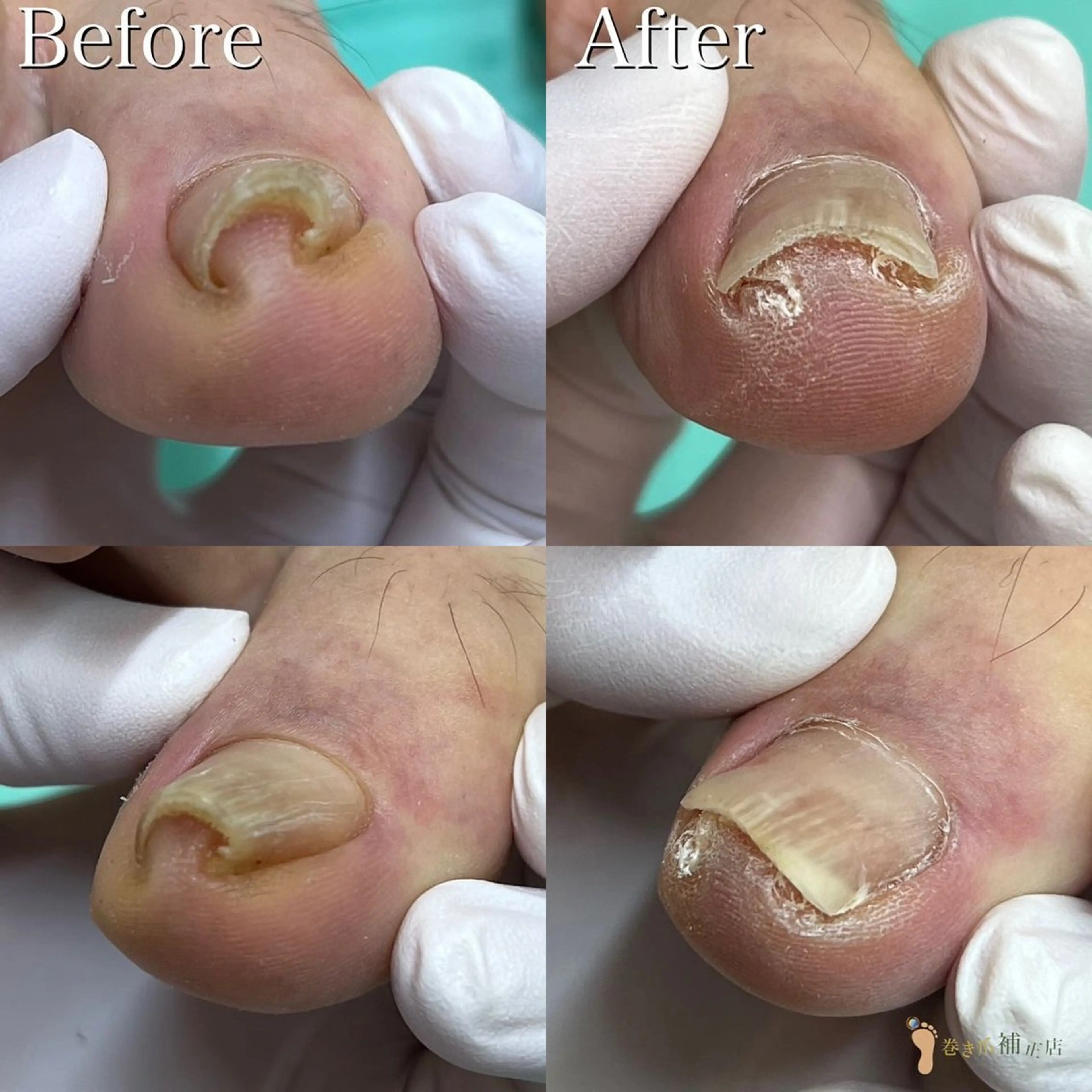 ネイル 大宮巻き爪補正店所属・大宮 巻き爪補正店のエステ・リラクイメージ