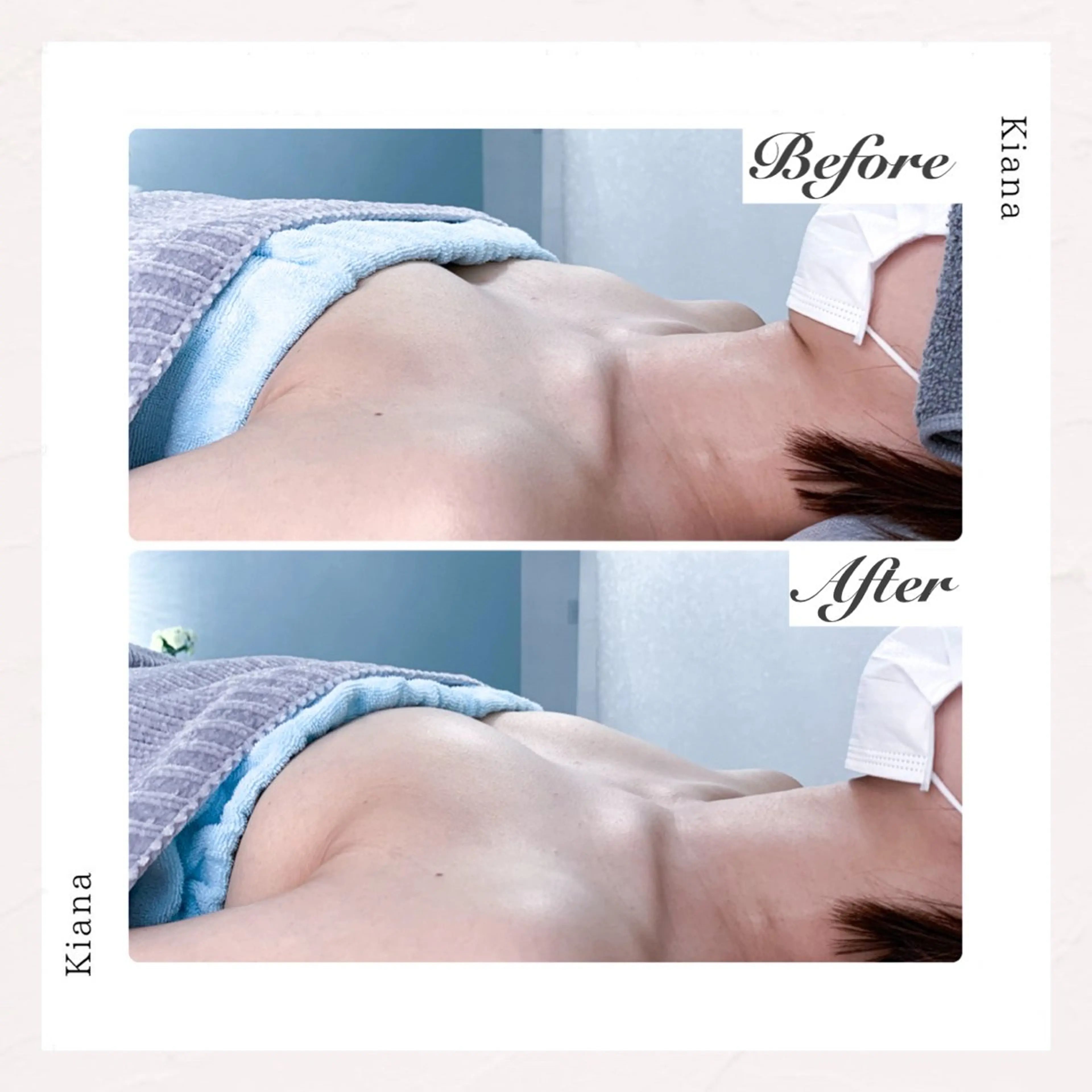 【2回目限定】バストオーダーメイド施術 80分の写真