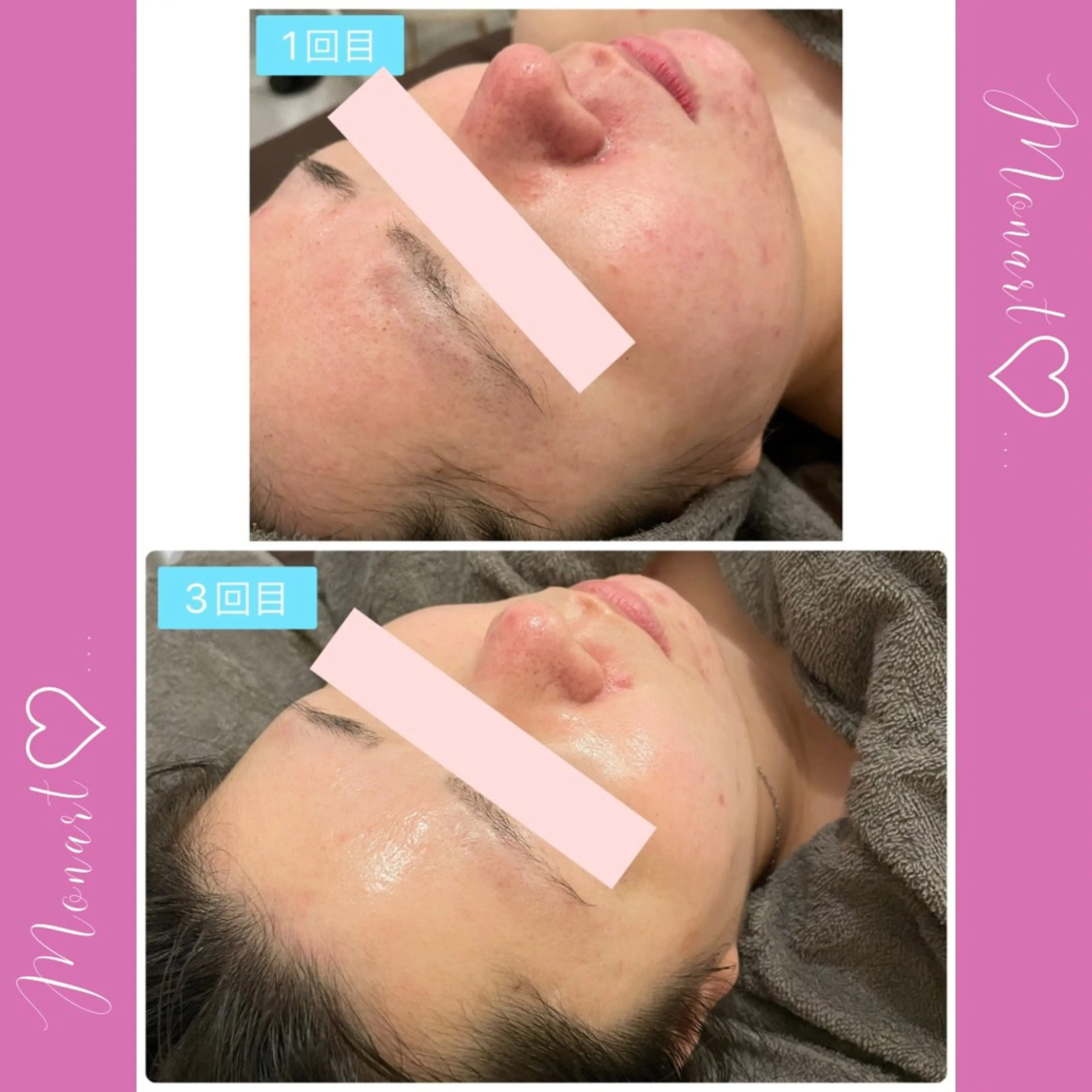 Monart -deux-のエステ・リラクイメージ