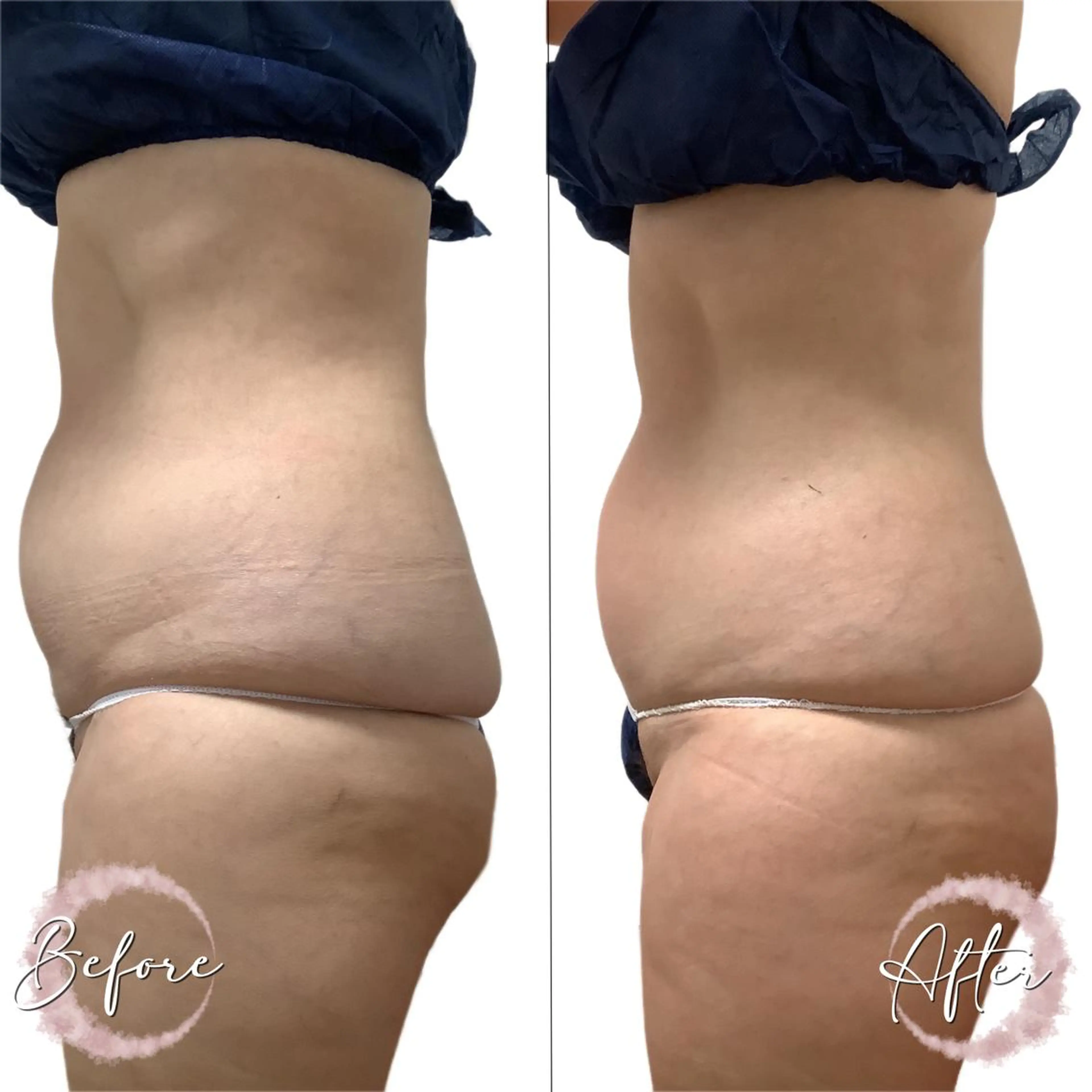 まつ毛パーマ・美肌 ナチュラル　ボーテのマツエク・マツパデザイン