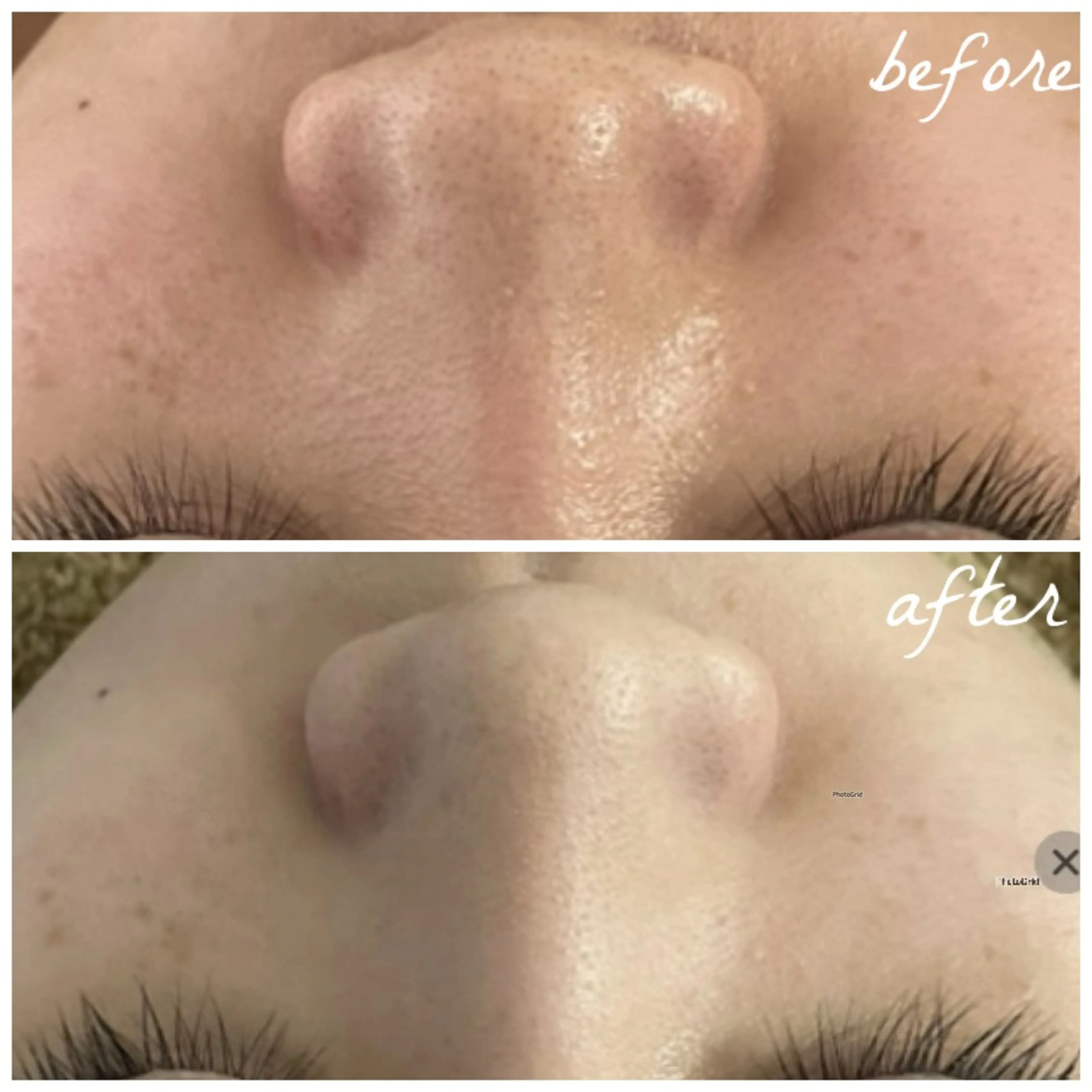 メンズ エステ メナード岐阜茜部 杉浦のエステ・リラクイメージ