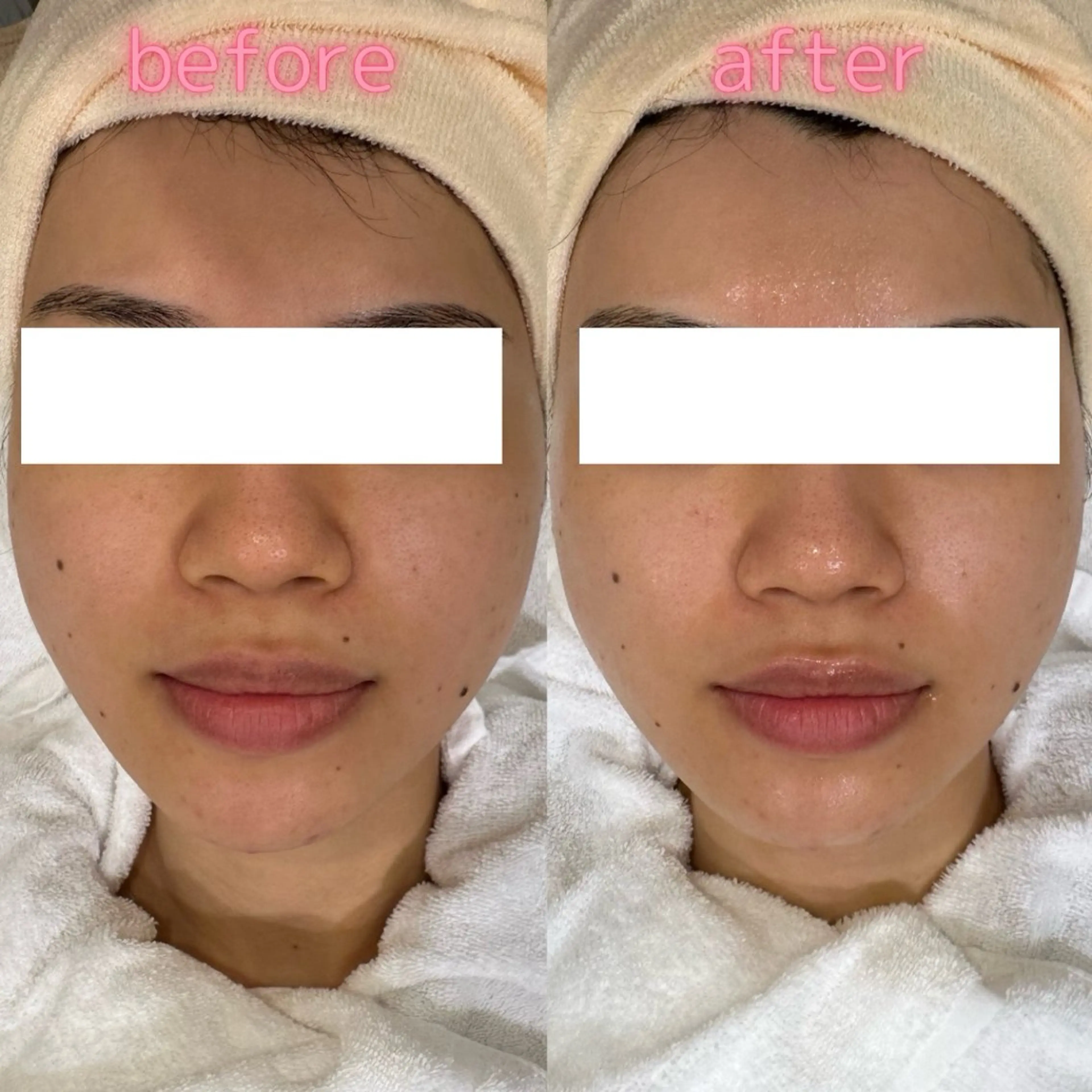 エステ pansy(パンジー)上野フェイシャルエステ専門店所属・pansy saraのエステ・リラクイメージ