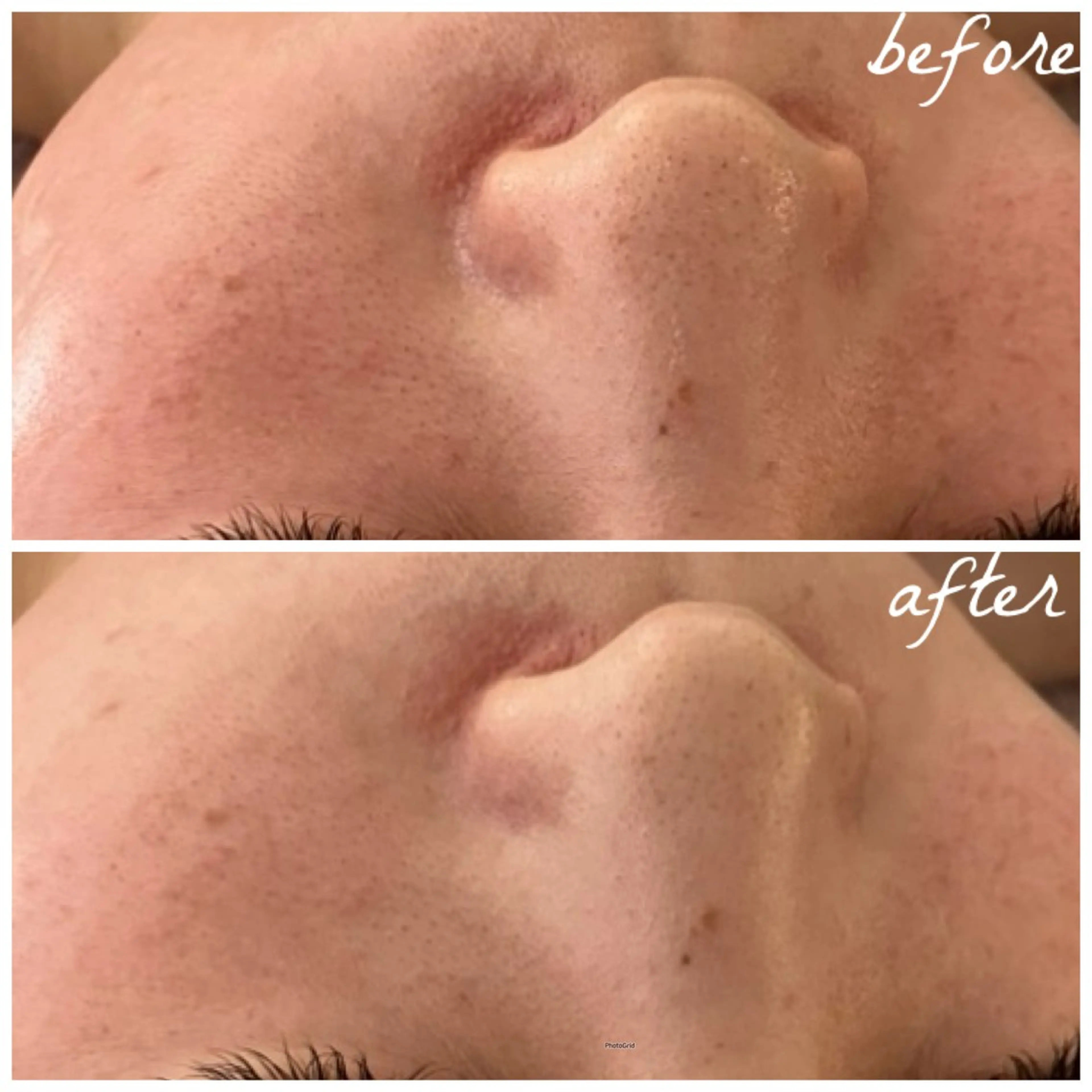 メンズ エステ メナード岐阜茜部 杉浦のエステ・リラクイメージ