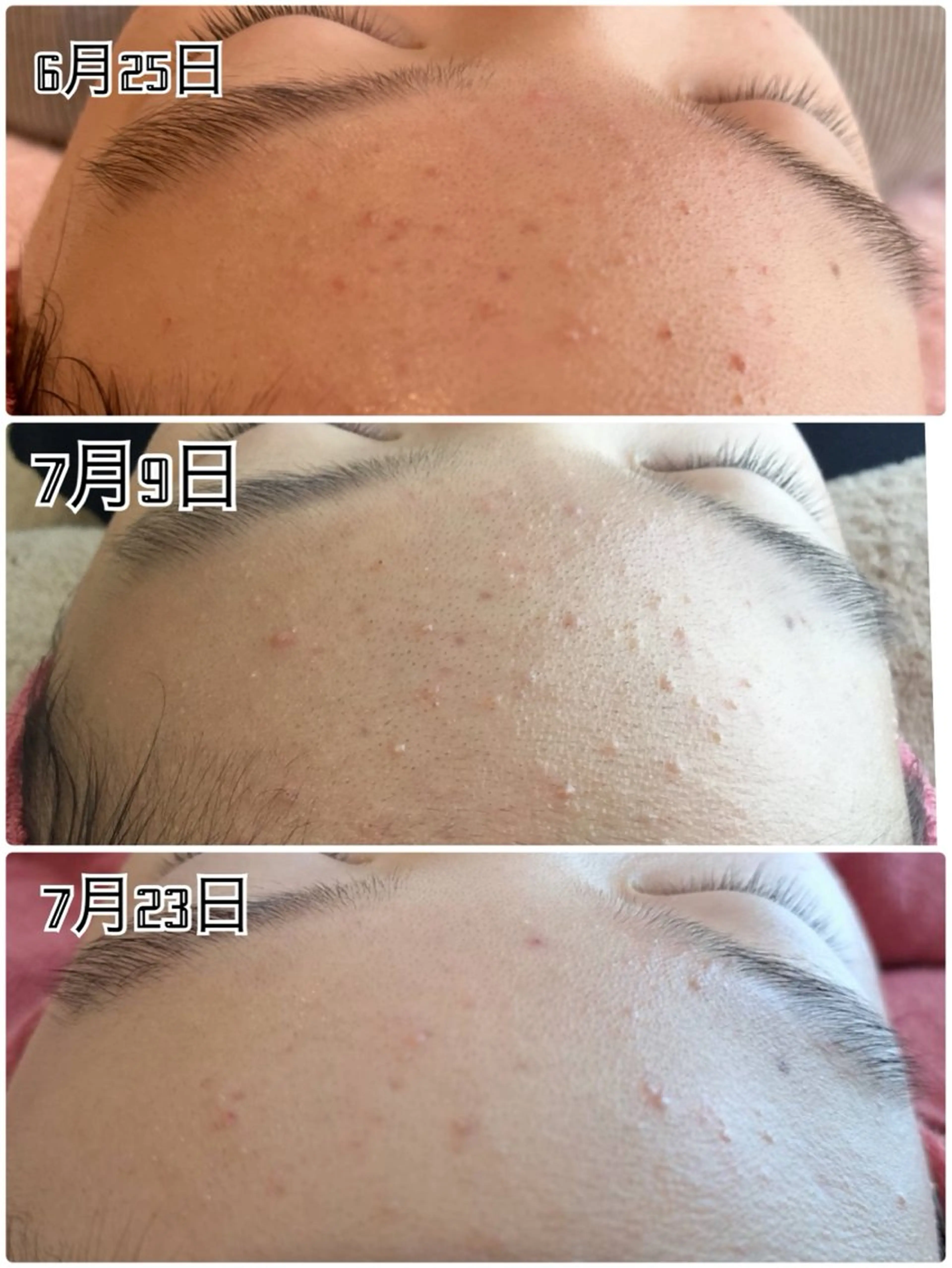 エステ 【リベルハーブピーリング認定店】敏感肌・美白脱毛専門店Dione立川店所属・Dione 立川店のエステ・リラクイメージ