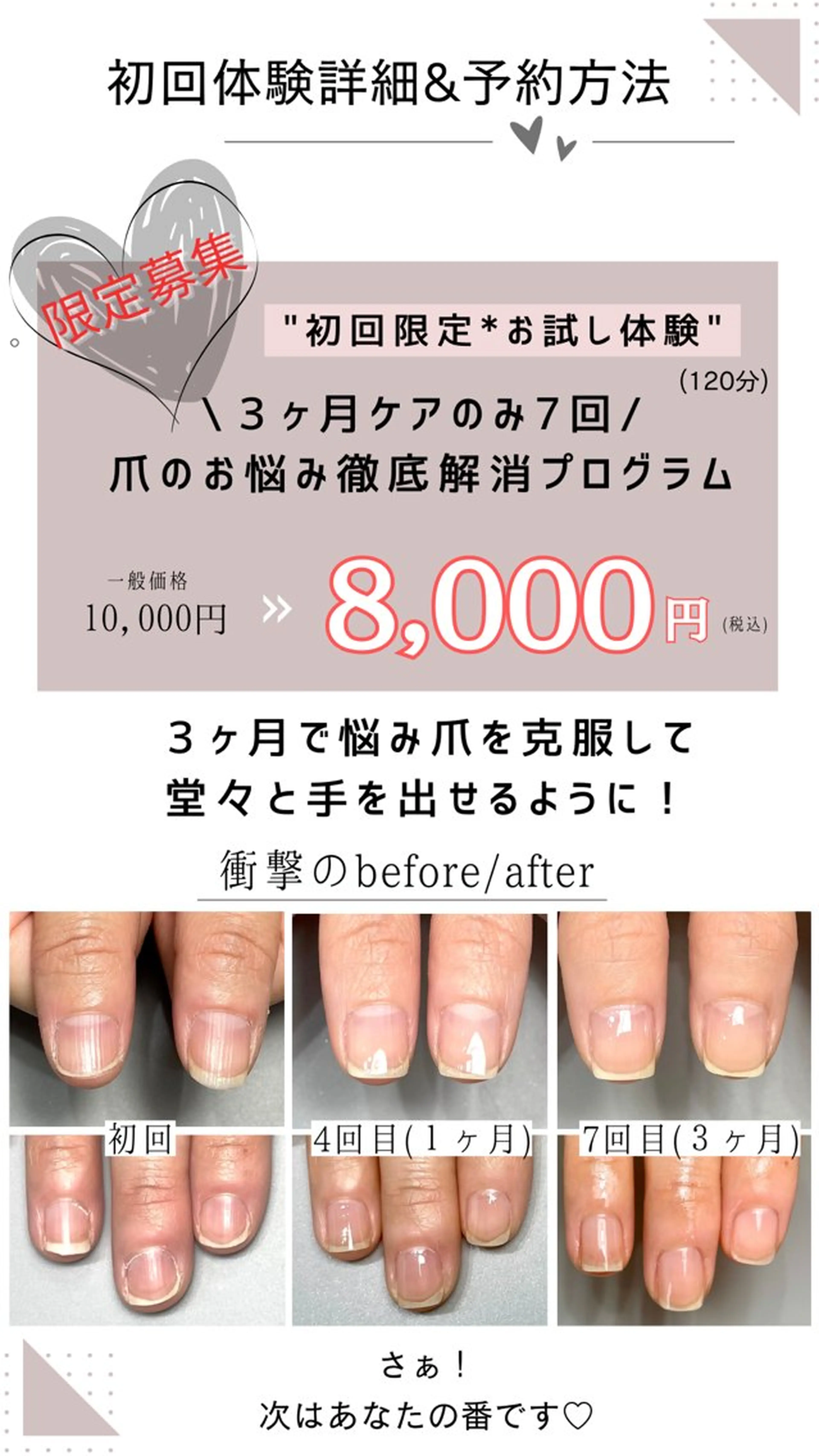 ネイル Aim* 深爪・自爪育成専門店のネイルデザイン