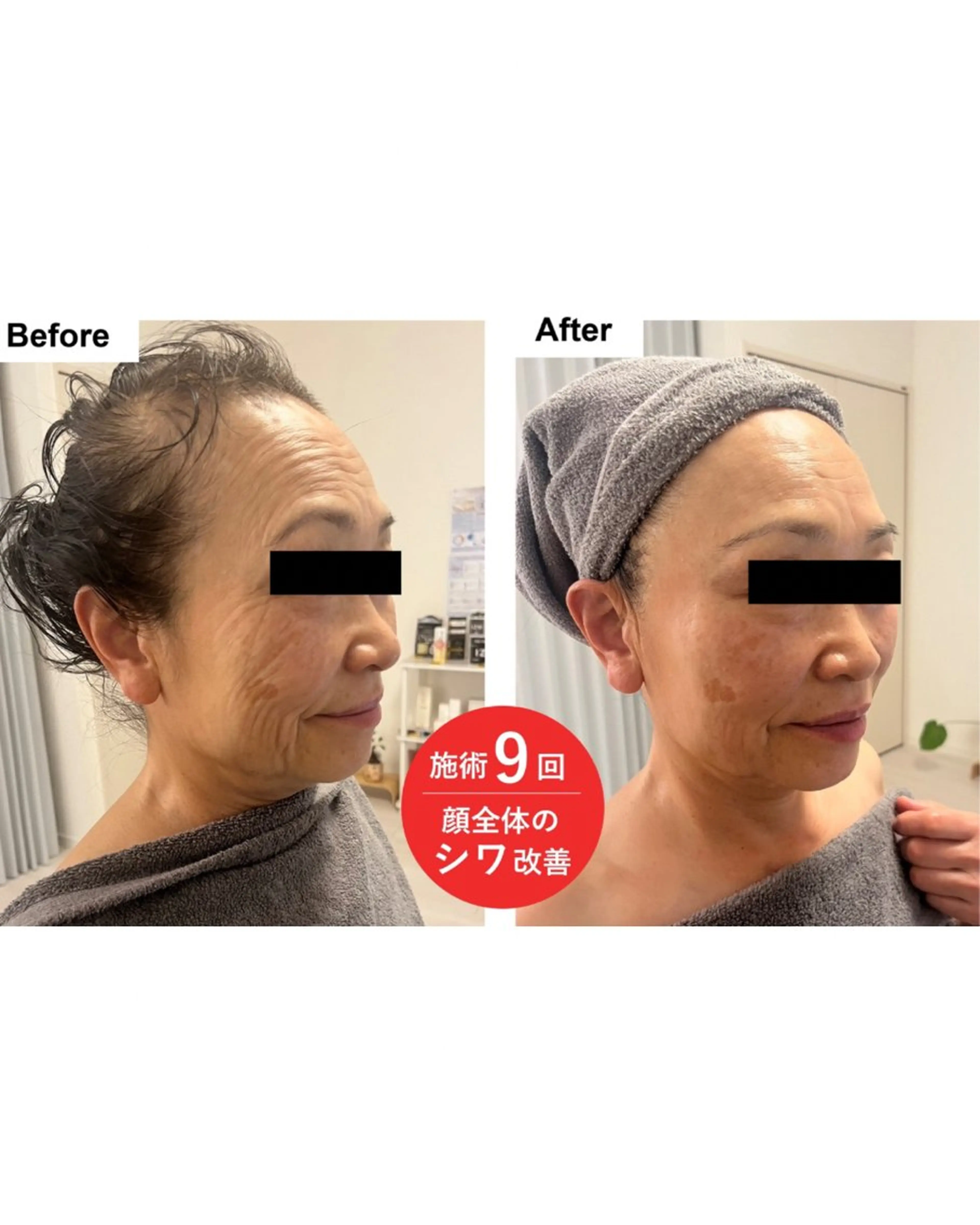 60分で-5歳肌✨プレミアムエステ🌸デコルテマッサージ付きの写真