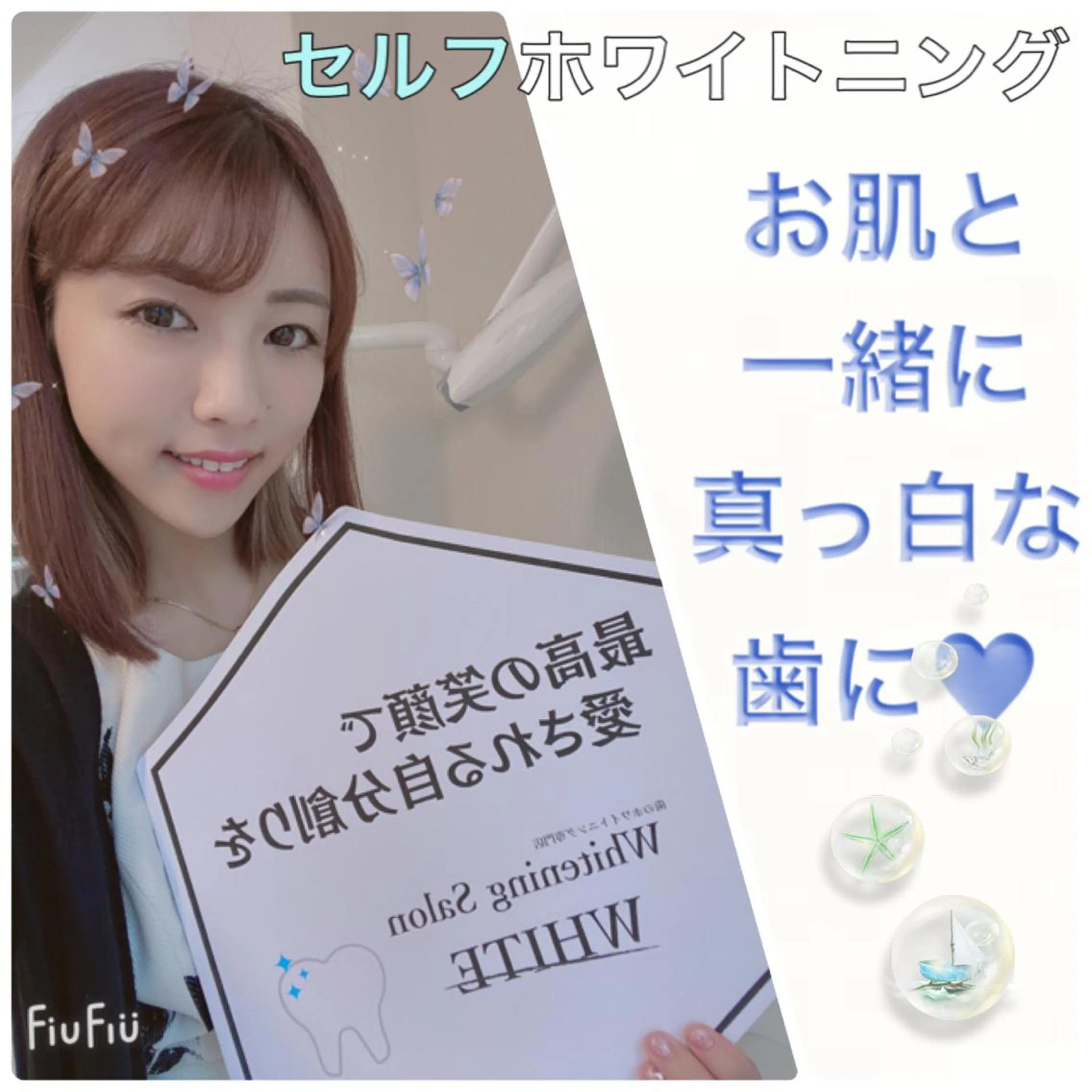 地域再安価セルフホワイトニング🦷内容チェック✨の写真