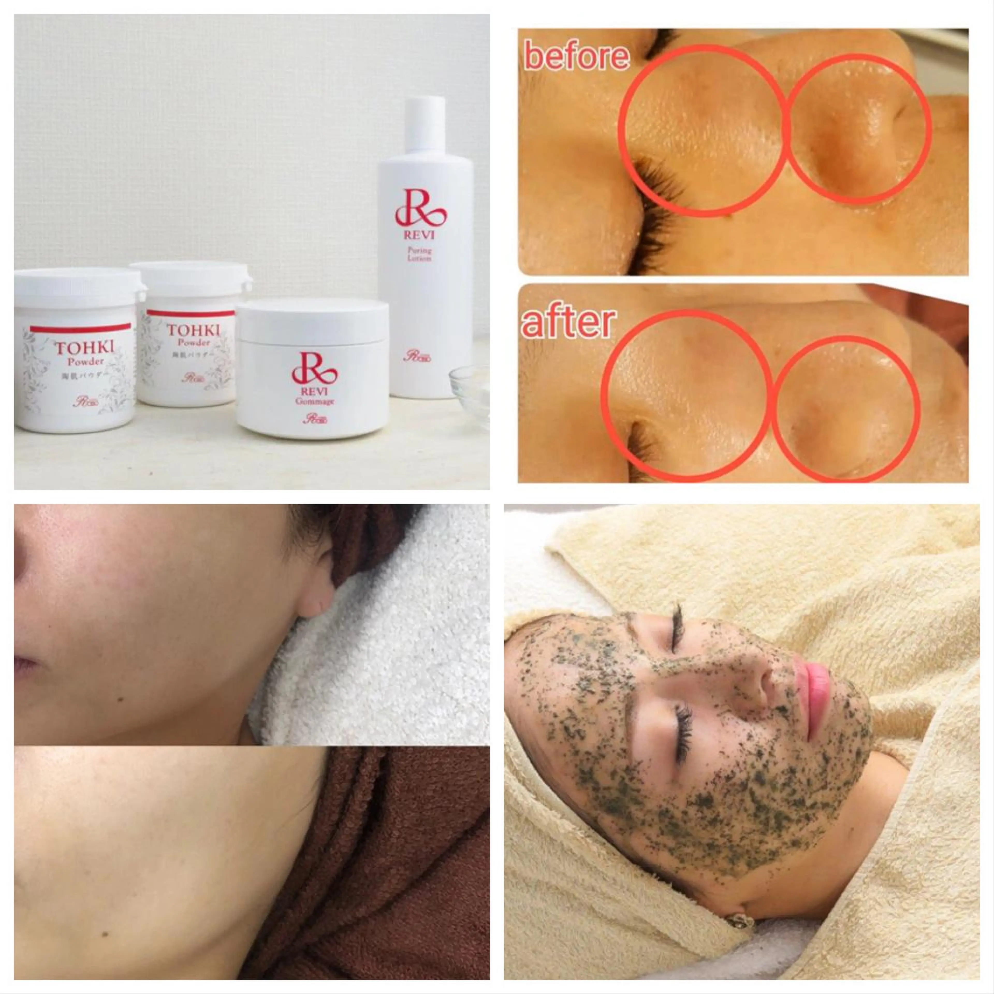 ブライダルエステ👰‍♀️💍REVI剥けないハーブピーリング🌿【フェイシャル】90分通常16500円→4400円の写真