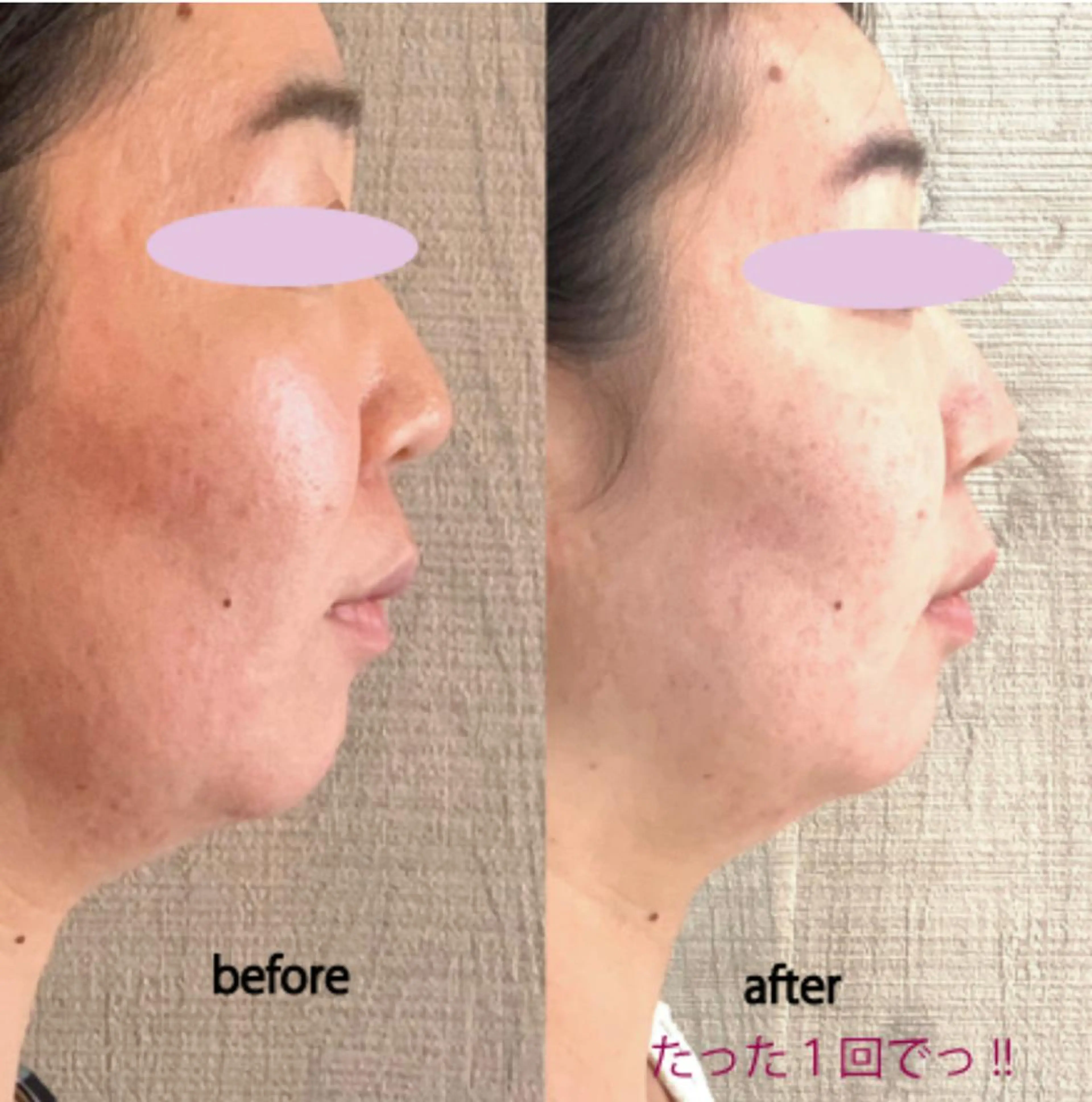 足から整える体メンテRe:アールイー所属・足から整える体メンテ Re:アールイーのその他イメージ