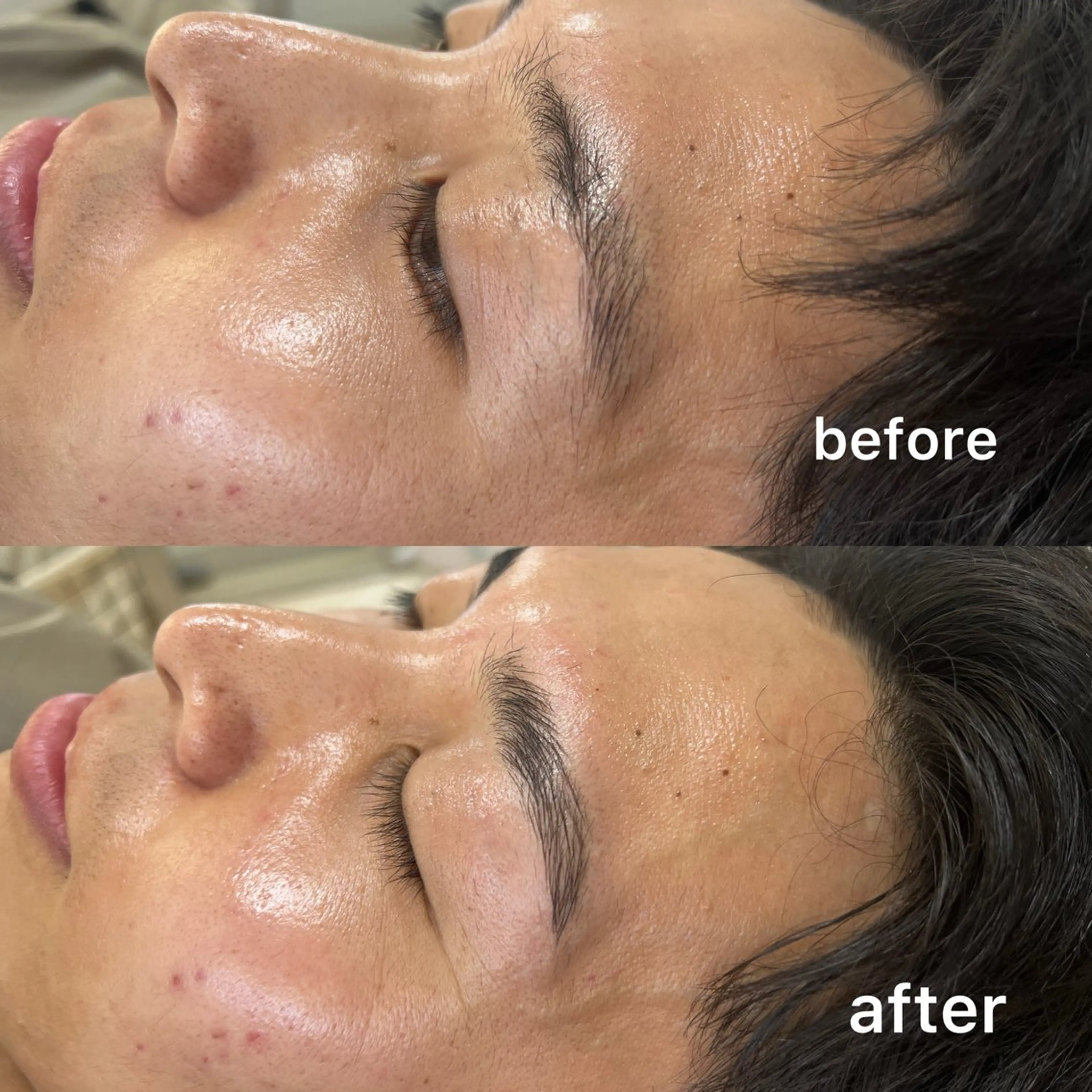 アイブロウ Akala miのエステ・リラクイメージ