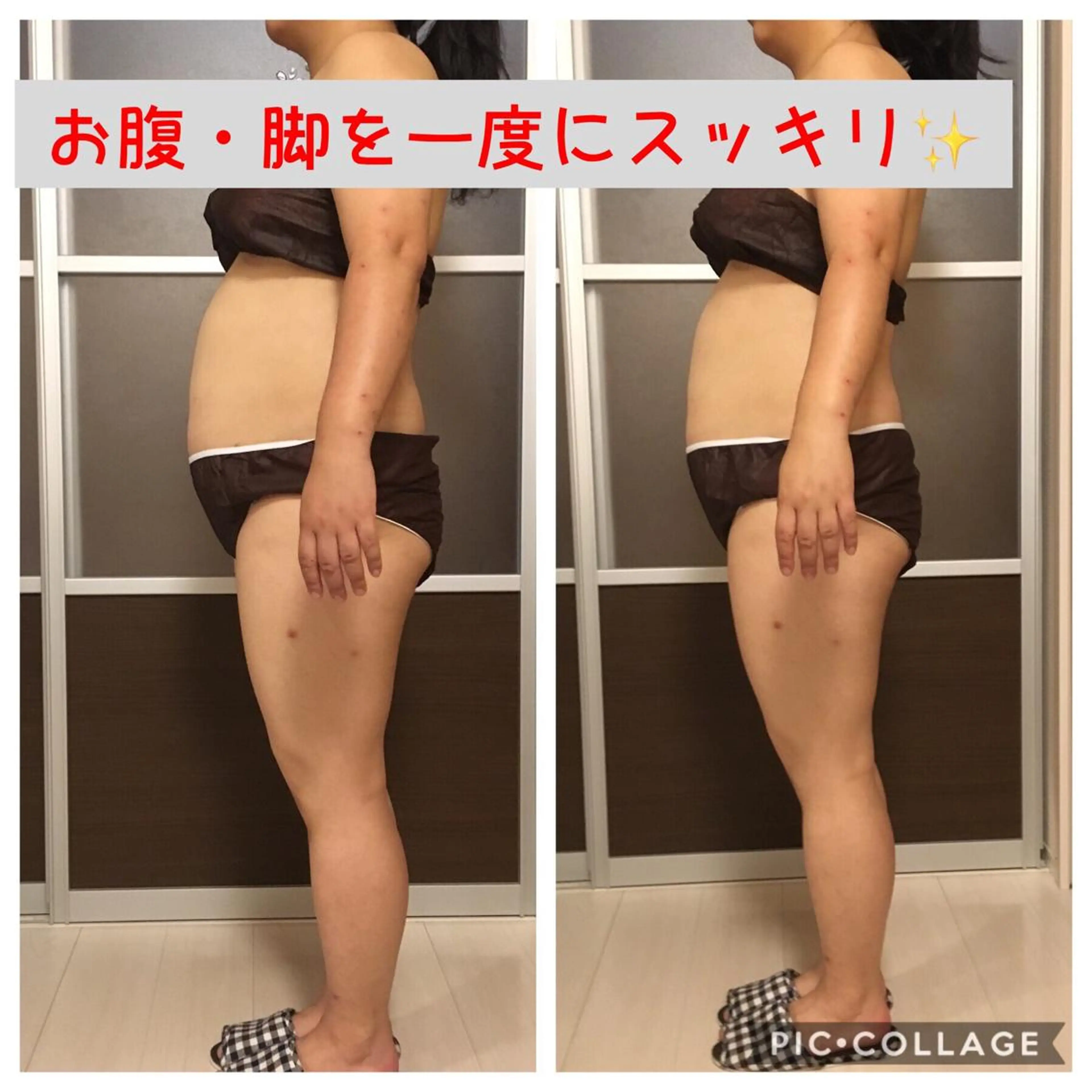 ロング カラー パーマ ヘアアレンジ メンズ キッズ ネイル マツエク・マツパ エステ リラク アニメ,Vオタク× 即効痩せエステサロンのエステ・リラクイメージ