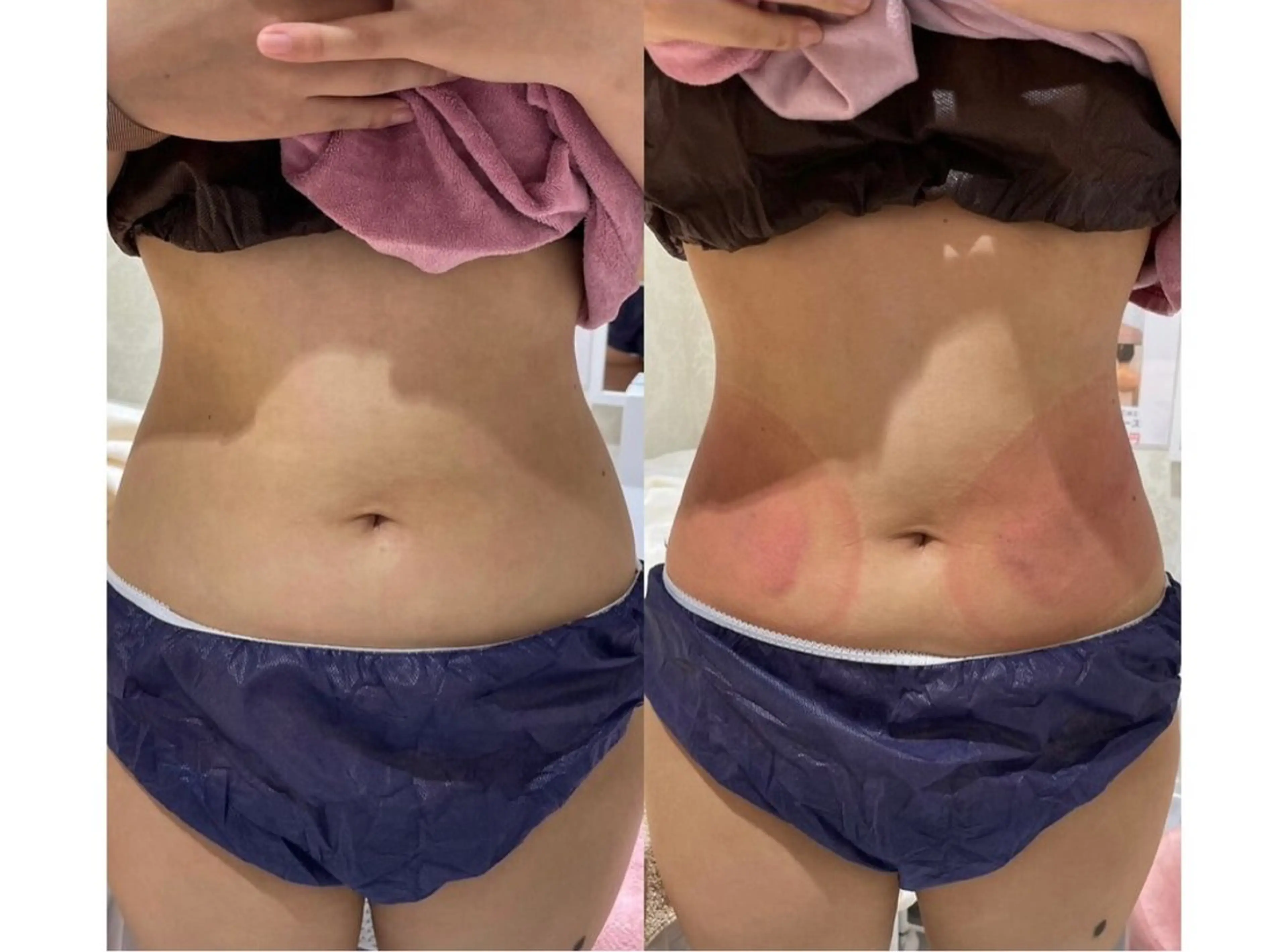 秒速小顔新宿南口 大谷のその他イメージ