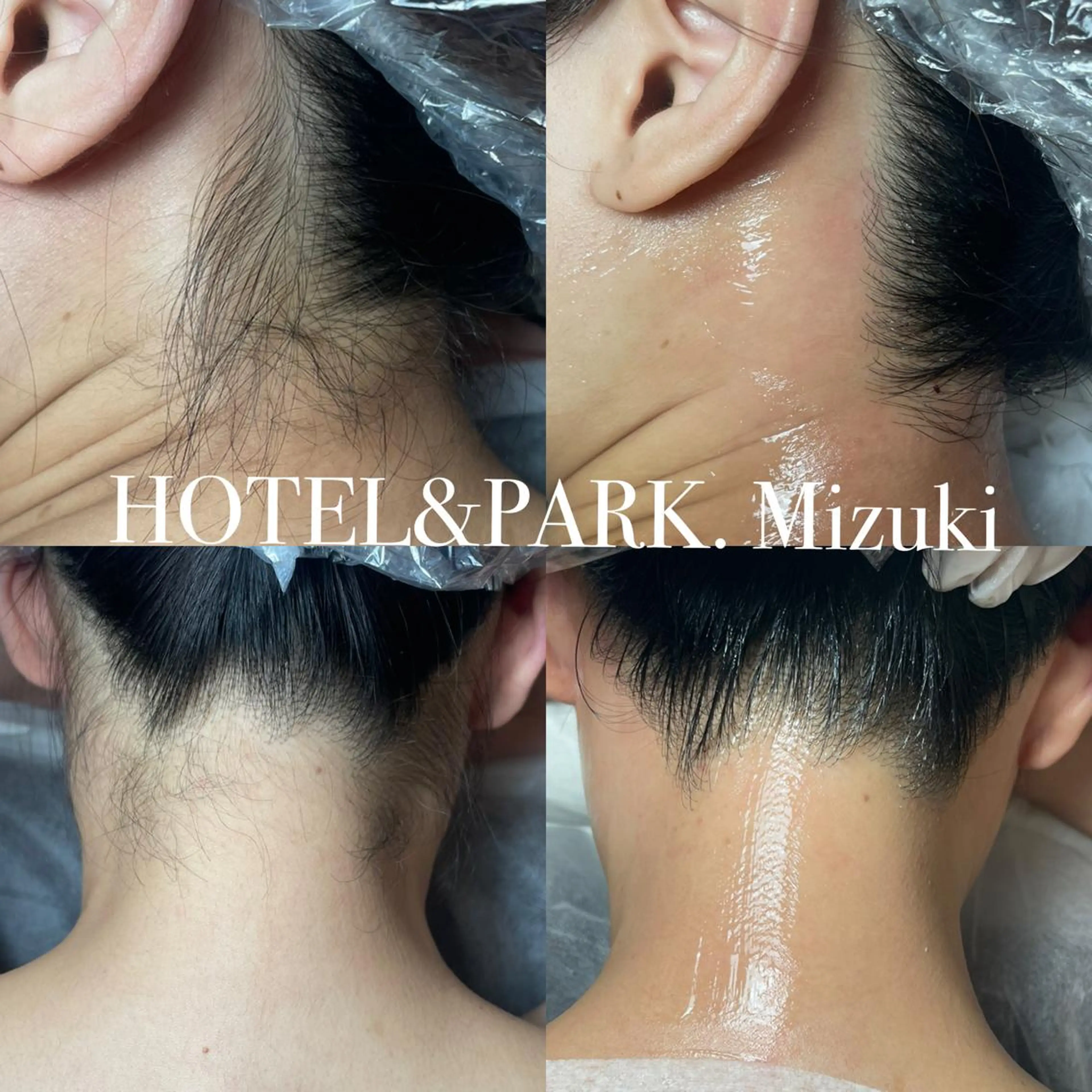 HOTEL&PARK . ワックス脱毛のエステ・リラクイメージ